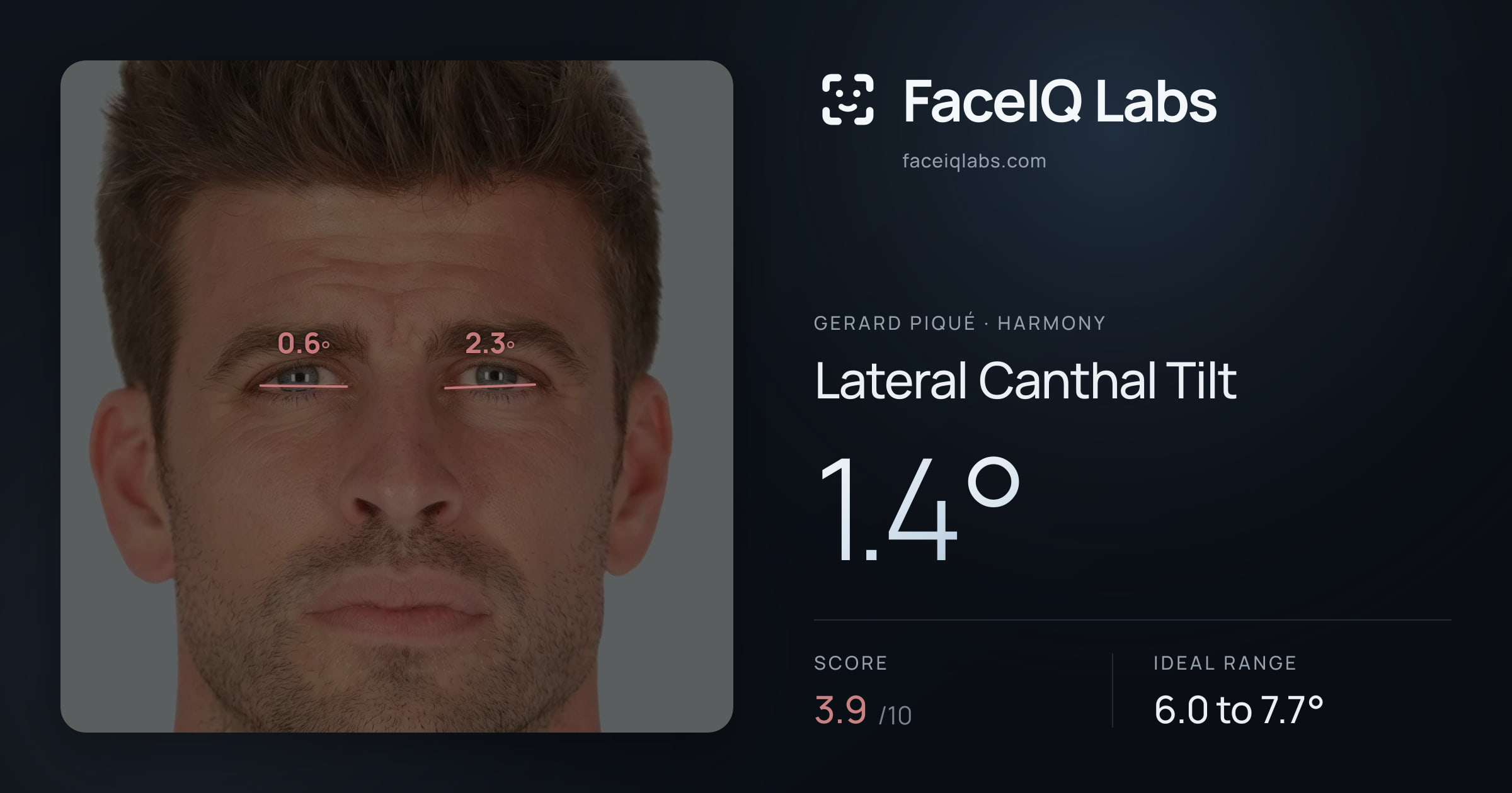 Gerard Piqué Lateral Canthal Tilt: 1.4°, drawn on the photo