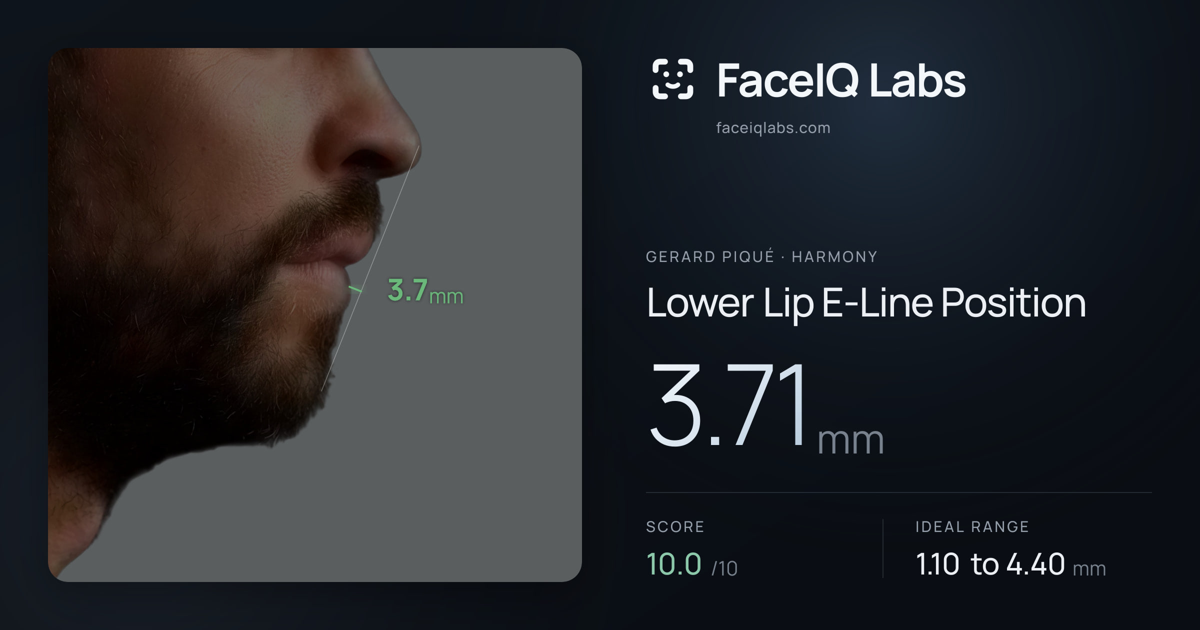 Gerard Piqué Lower Lip E-Line Position: 3.71mm, drawn on the photo