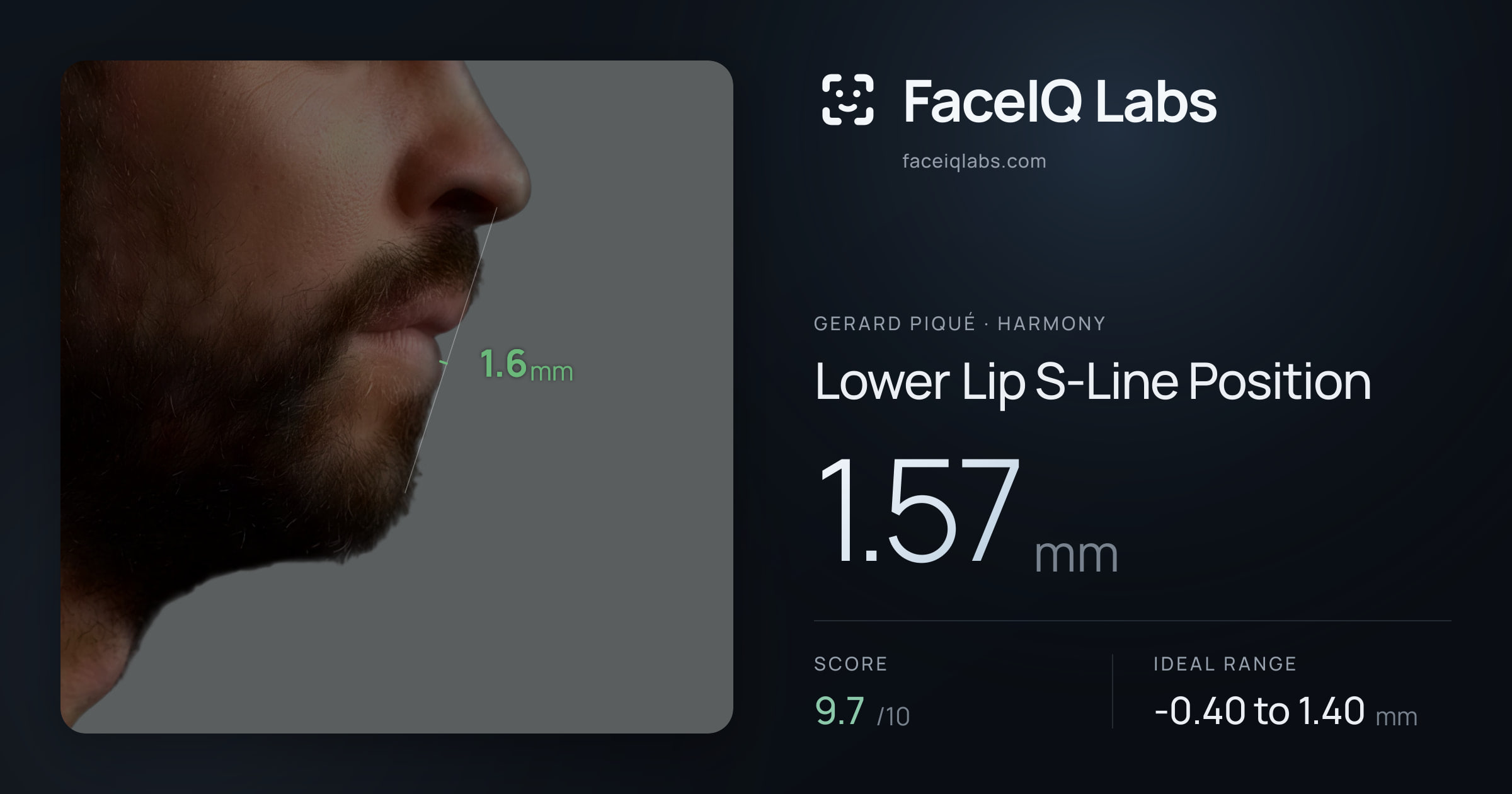 Gerard Piqué Lower Lip S-Line Position: 1.57mm, drawn on the photo