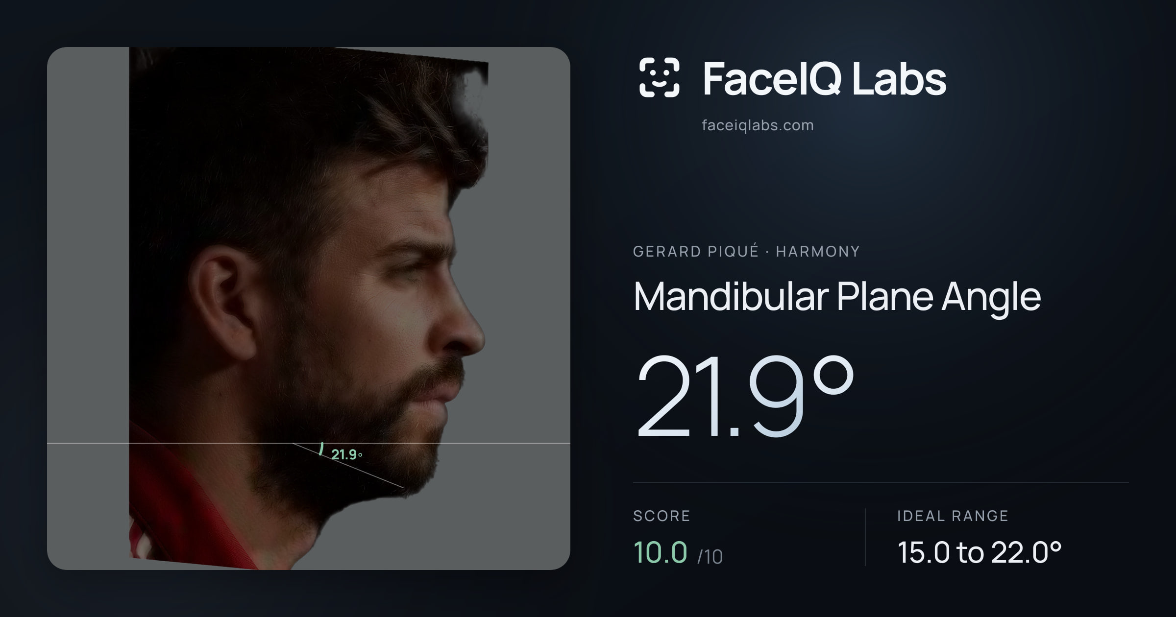 Gerard Piqué Mandibular Plane Angle: 21.9°, drawn on the photo