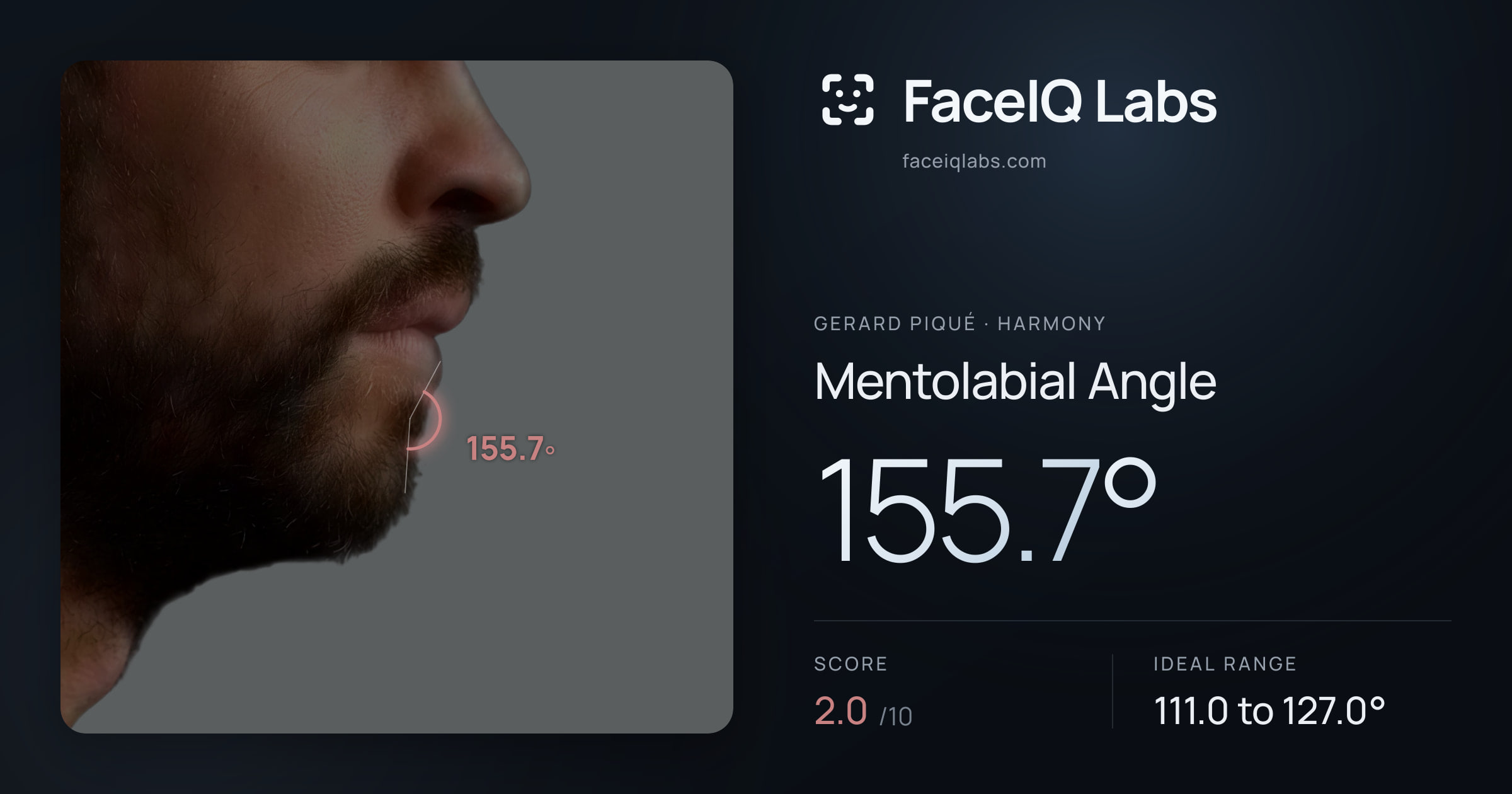 Gerard Piqué Mentolabial Angle: 155.7°, drawn on the photo
