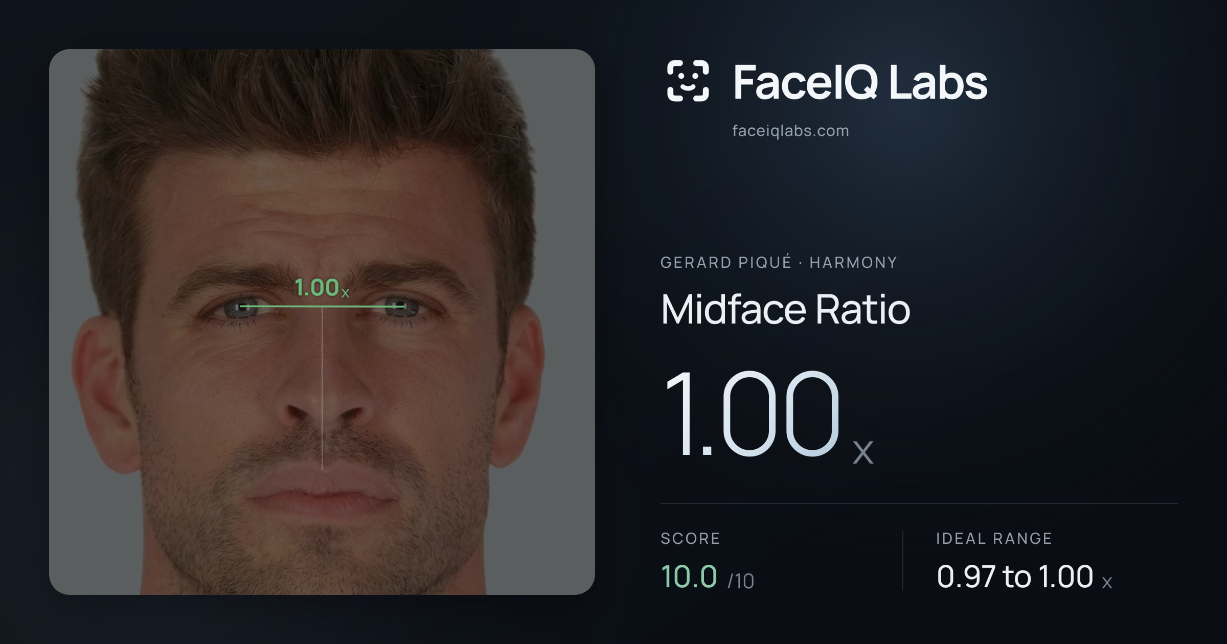 Gerard Piqué Midface Ratio: 1.00x, drawn on the photo