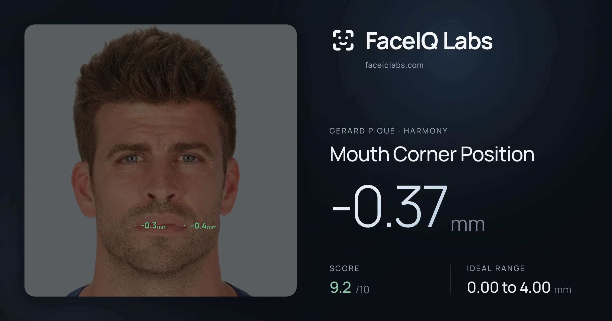 Gerard Piqué Mouth Corner Position: -0.37mm, drawn on the photo