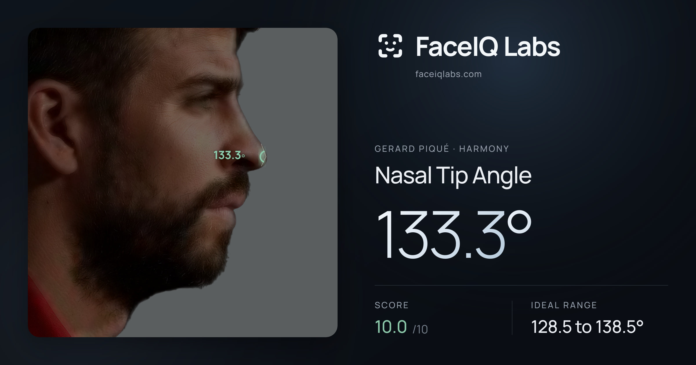 Gerard Piqué Nasal Tip Angle: 133.3°, drawn on the photo