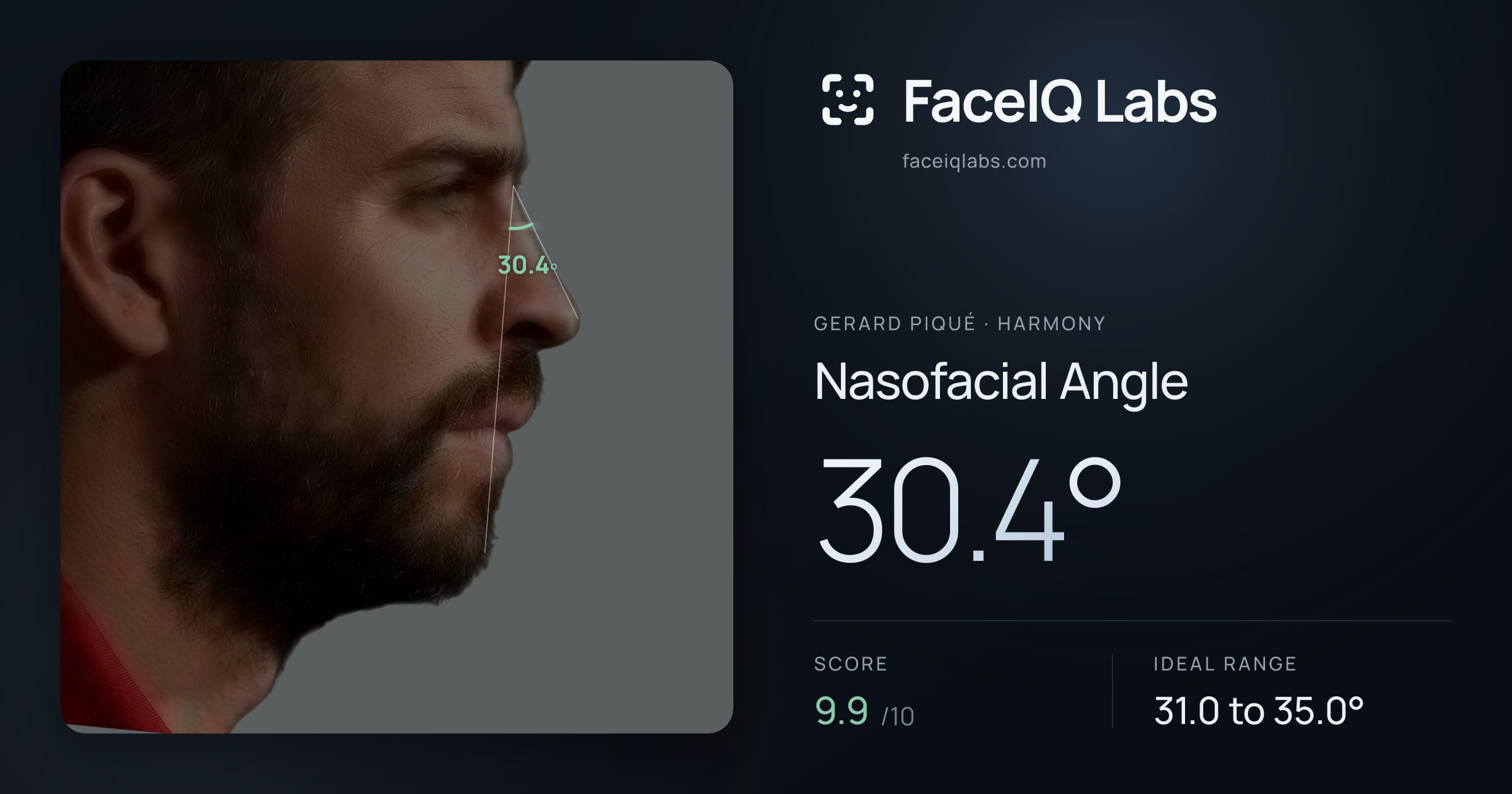 Gerard Piqué Nasofacial Angle: 30.4°, drawn on the photo