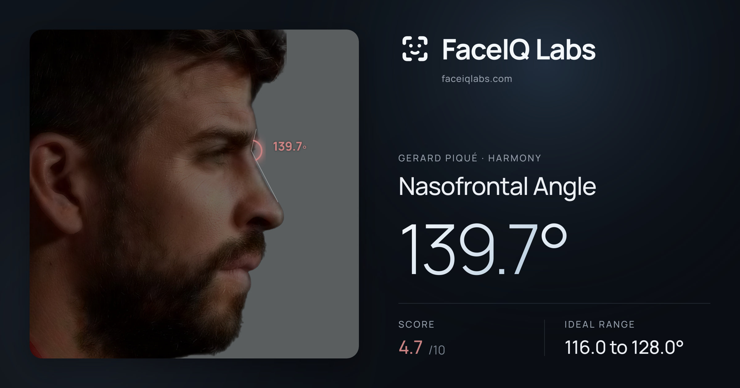 Gerard Piqué Nasofrontal Angle: 139.7°, drawn on the photo