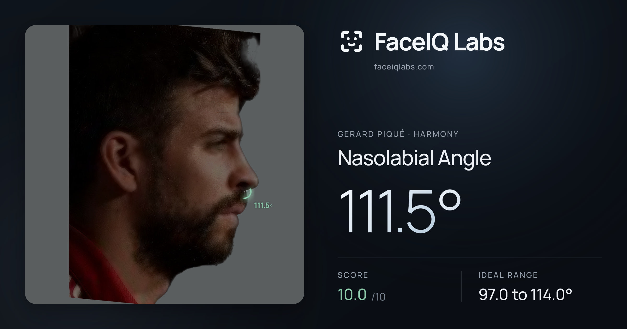 Gerard Piqué Nasolabial Angle: 111.5°, drawn on the photo