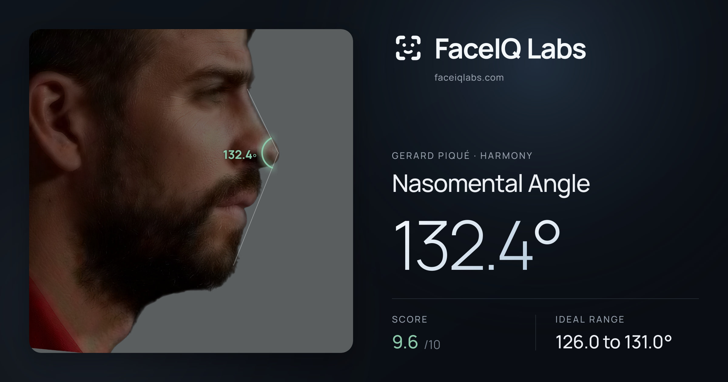 Gerard Piqué Nasomental Angle: 132.4°, drawn on the photo