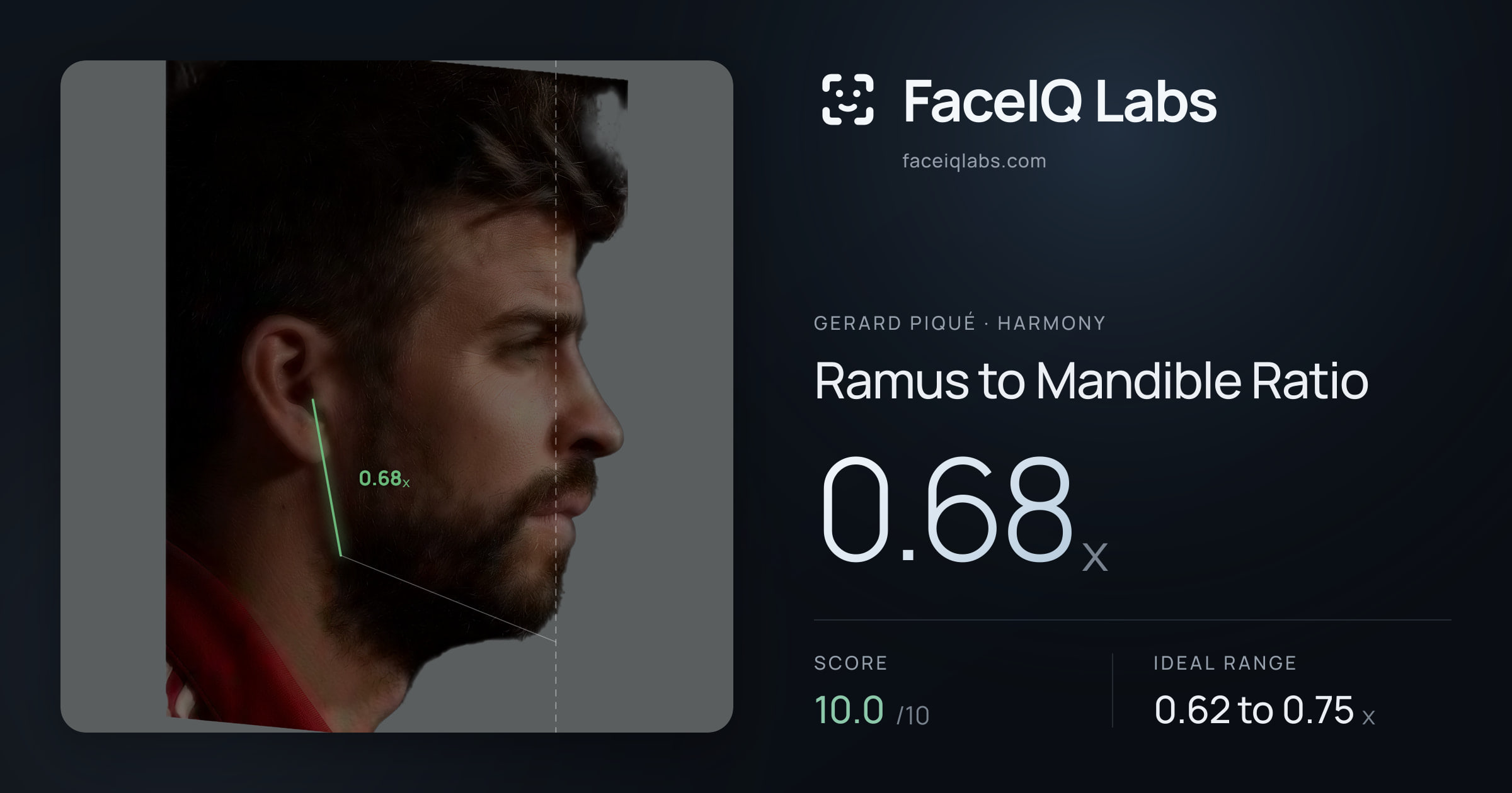 Gerard Piqué Ramus to Mandible Ratio: 0.68x, drawn on the photo