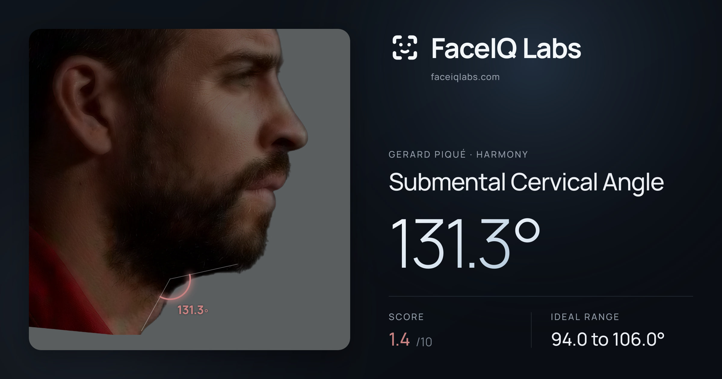 Gerard Piqué Submental Cervical Angle: 131.3°, drawn on the photo