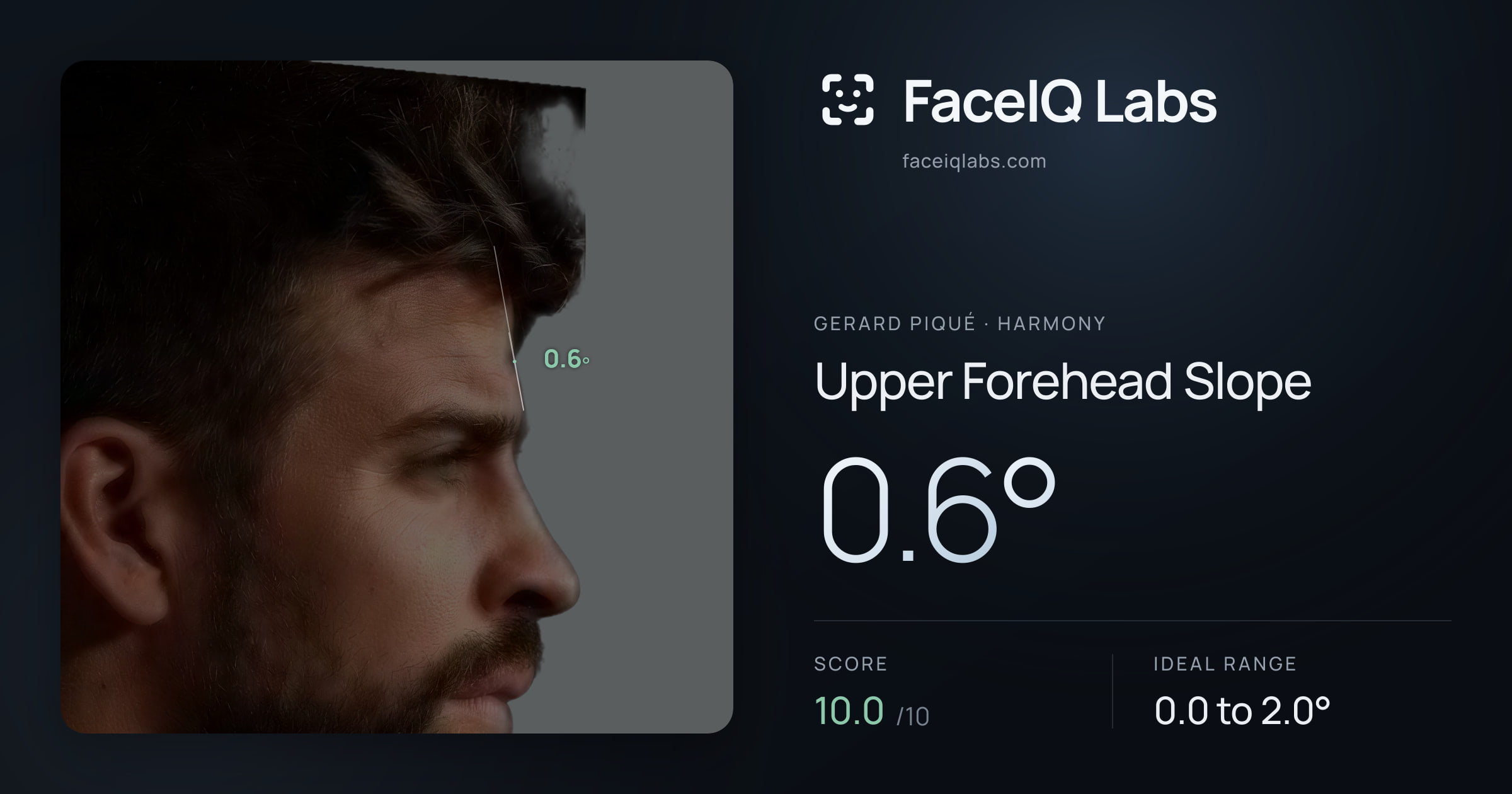 Gerard Piqué Upper Forehead Slope: 0.6°, drawn on the photo