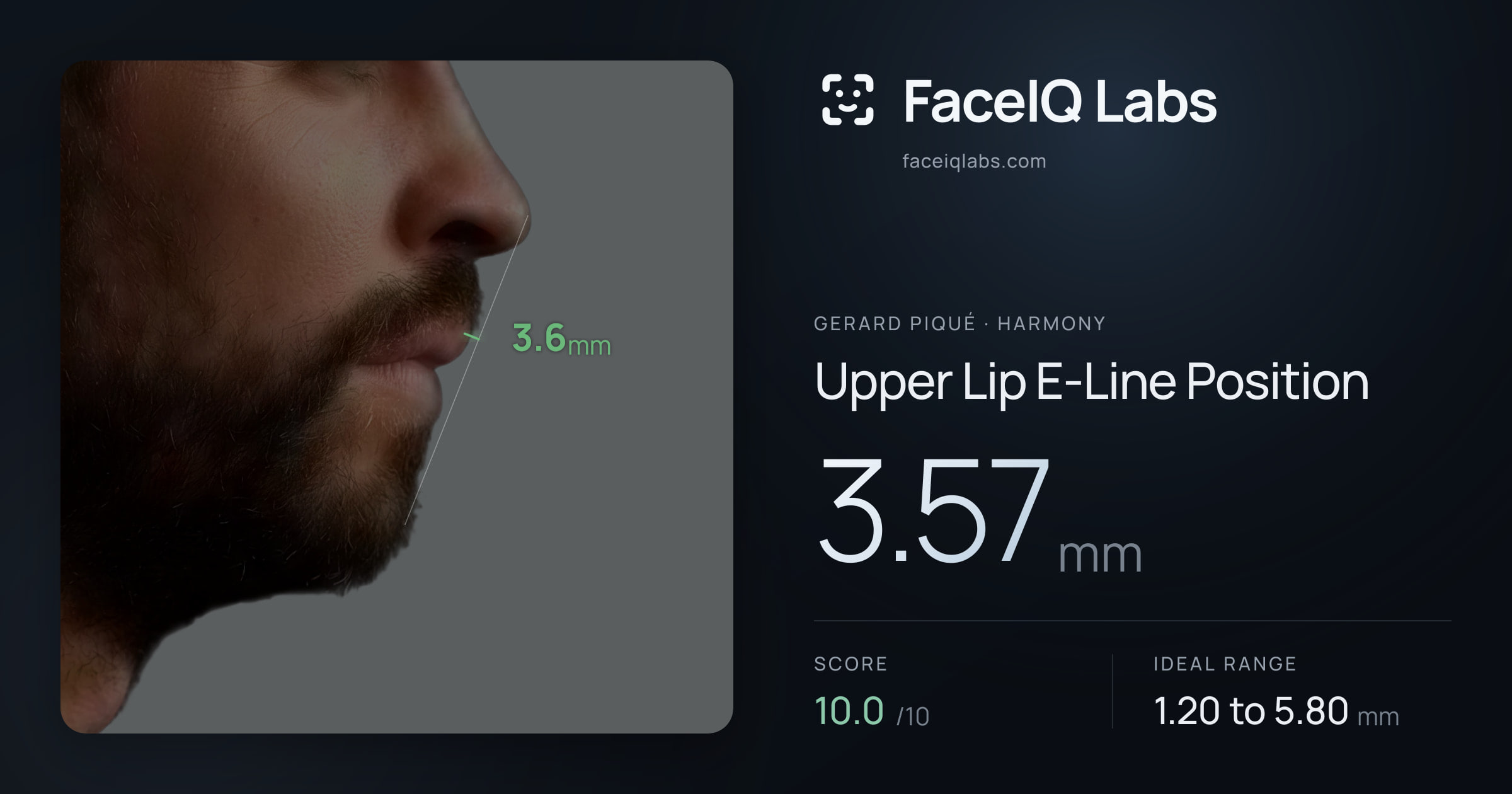 Gerard Piqué Upper Lip E-Line Position: 3.57mm, drawn on the photo