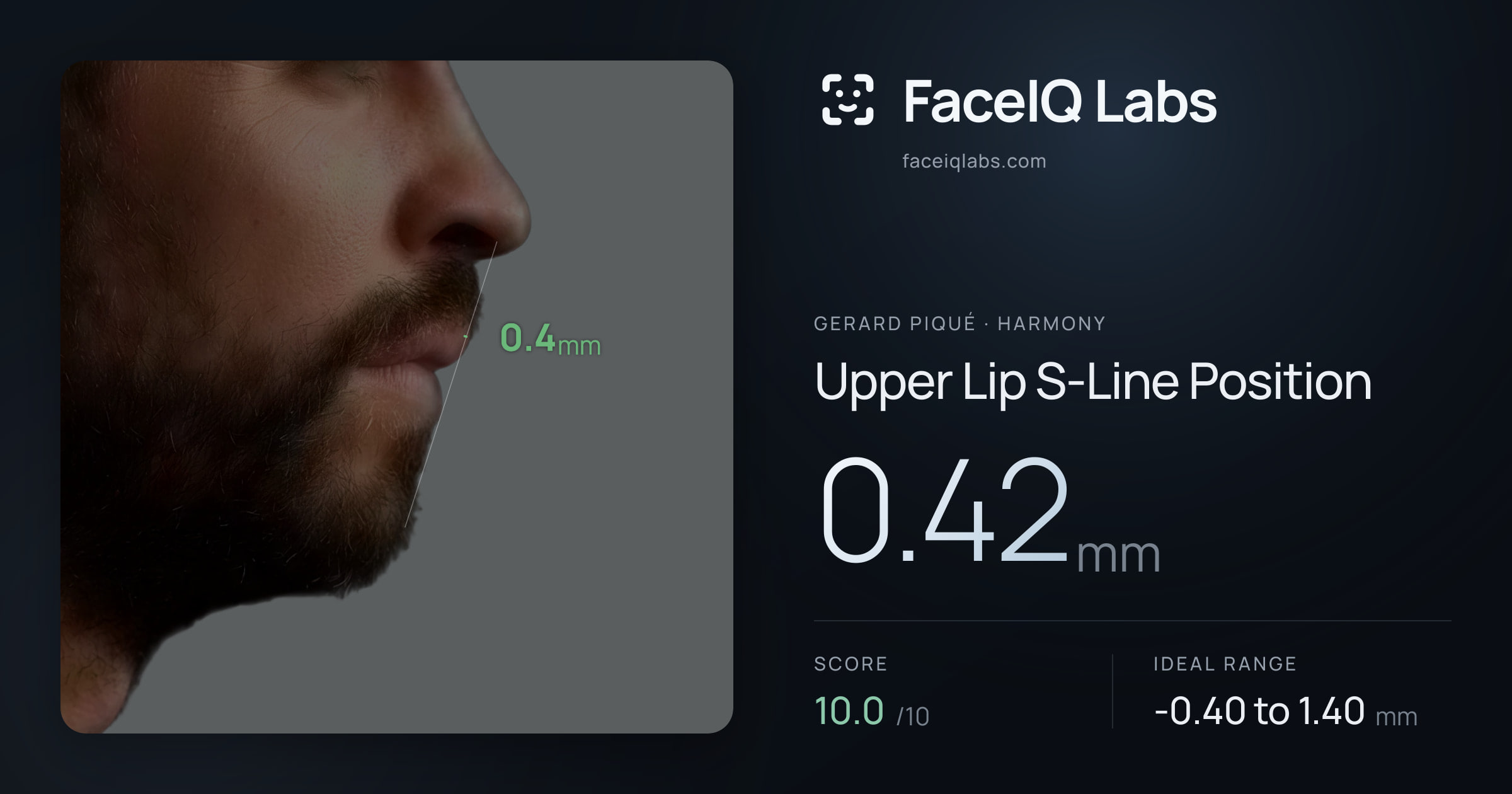 Gerard Piqué Upper Lip S-Line Position: 0.42mm, drawn on the photo