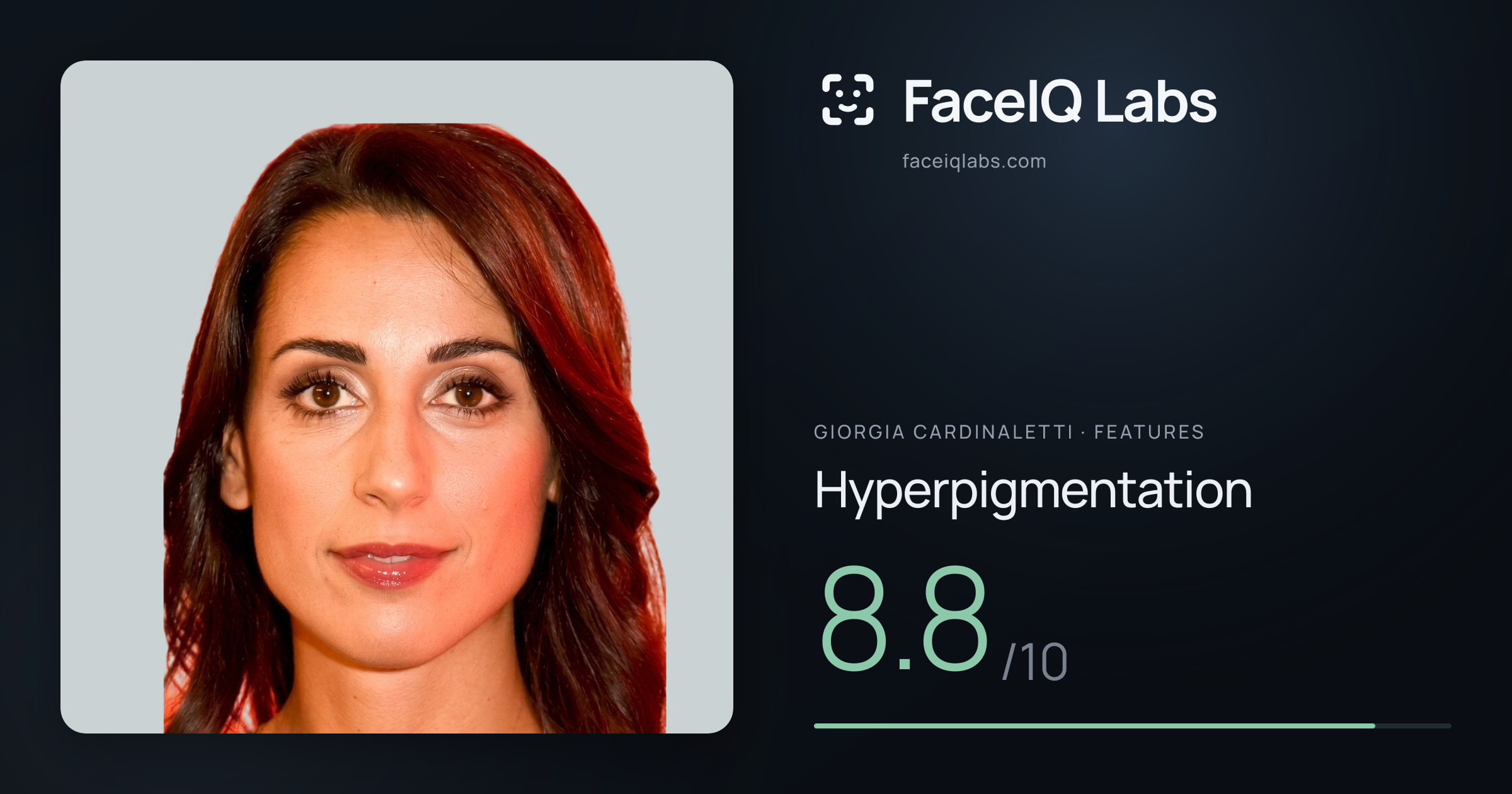 Giorgia Cardinaletti Hyperpigmentation: 8.8/10, drawn on the photo