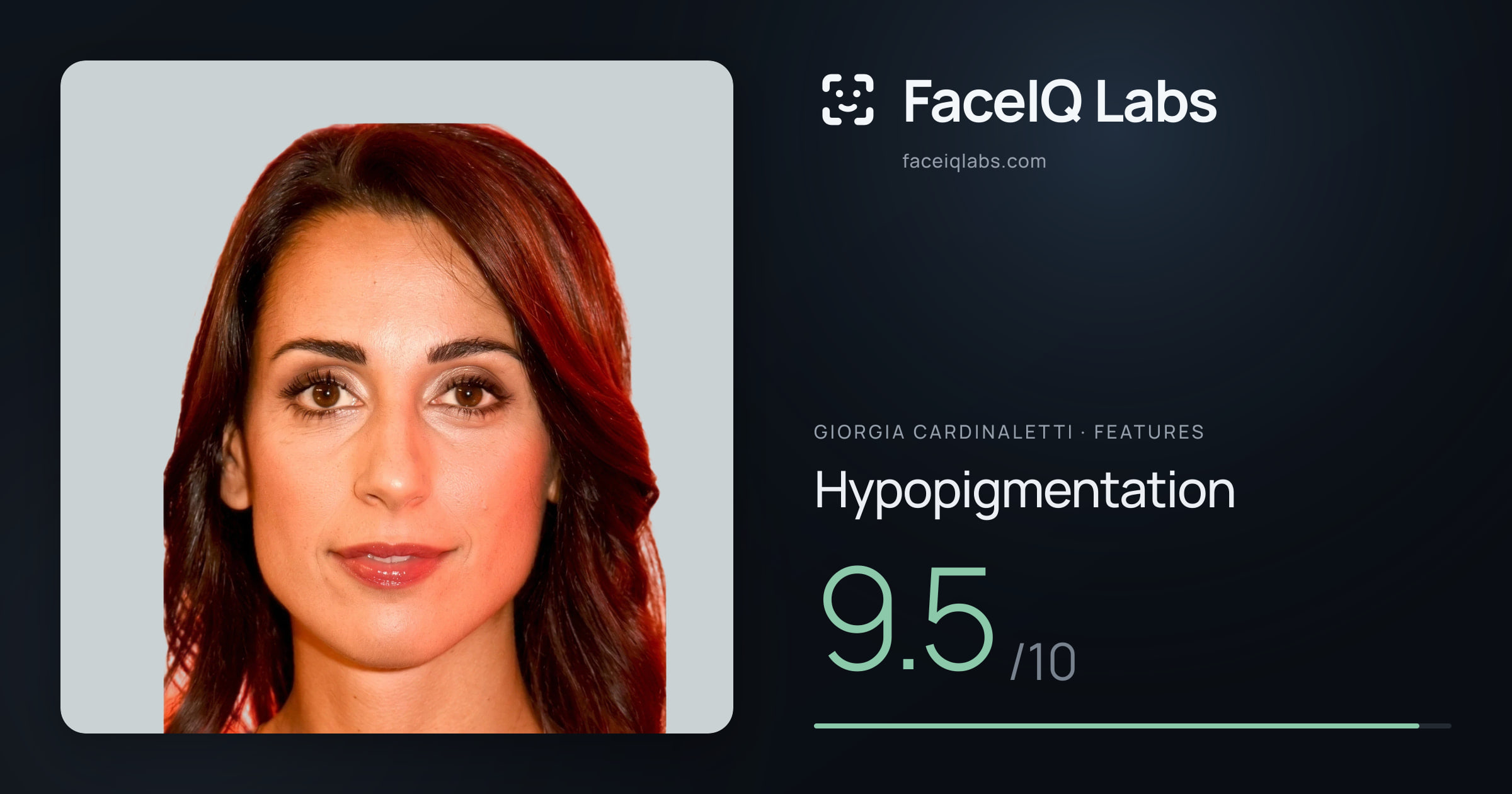 Giorgia Cardinaletti Hypopigmentation: 9.5/10, drawn on the photo