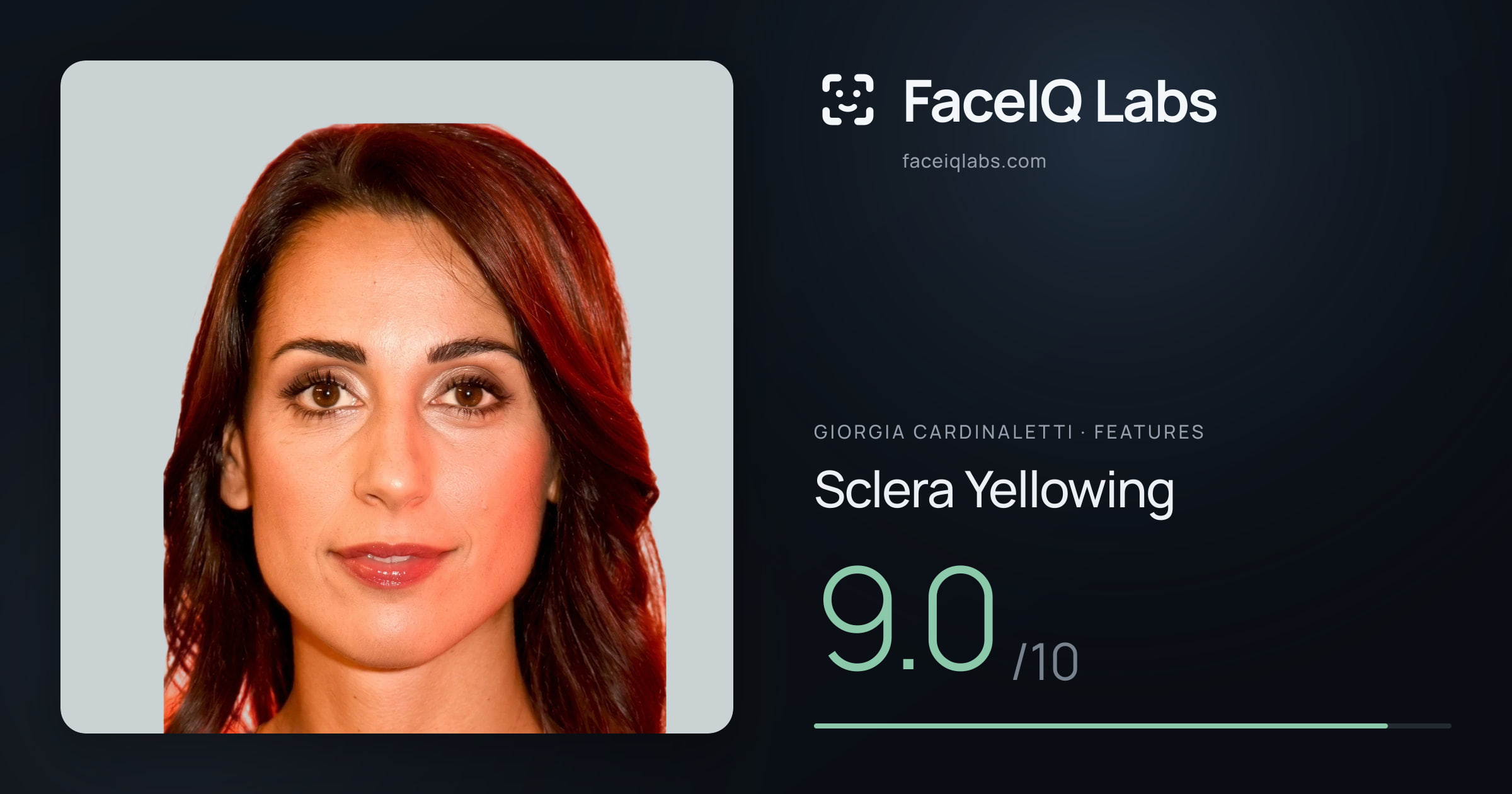 Giorgia Cardinaletti Sclera Yellowing: 9.0/10, drawn on the photo