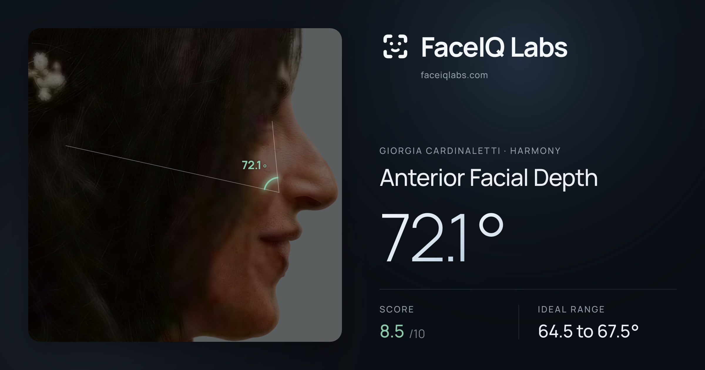 Giorgia Cardinaletti Anterior Facial Depth: 72.1°, drawn on the photo