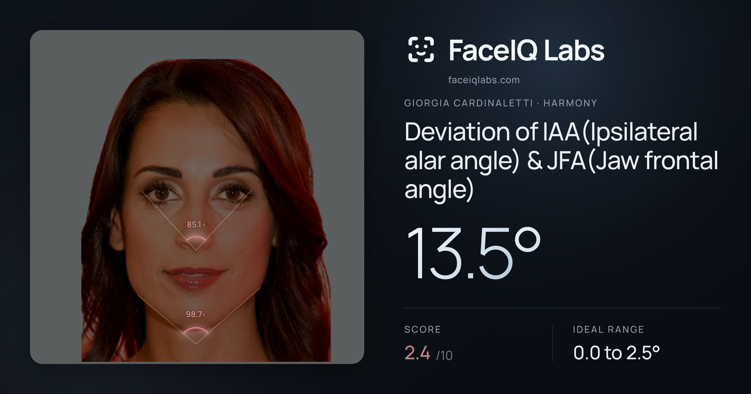 Giorgia Cardinaletti Deviation of IAA(Ipsilateral alar angle) & JFA(Jaw frontal angle): 13.5°, drawn on the photo