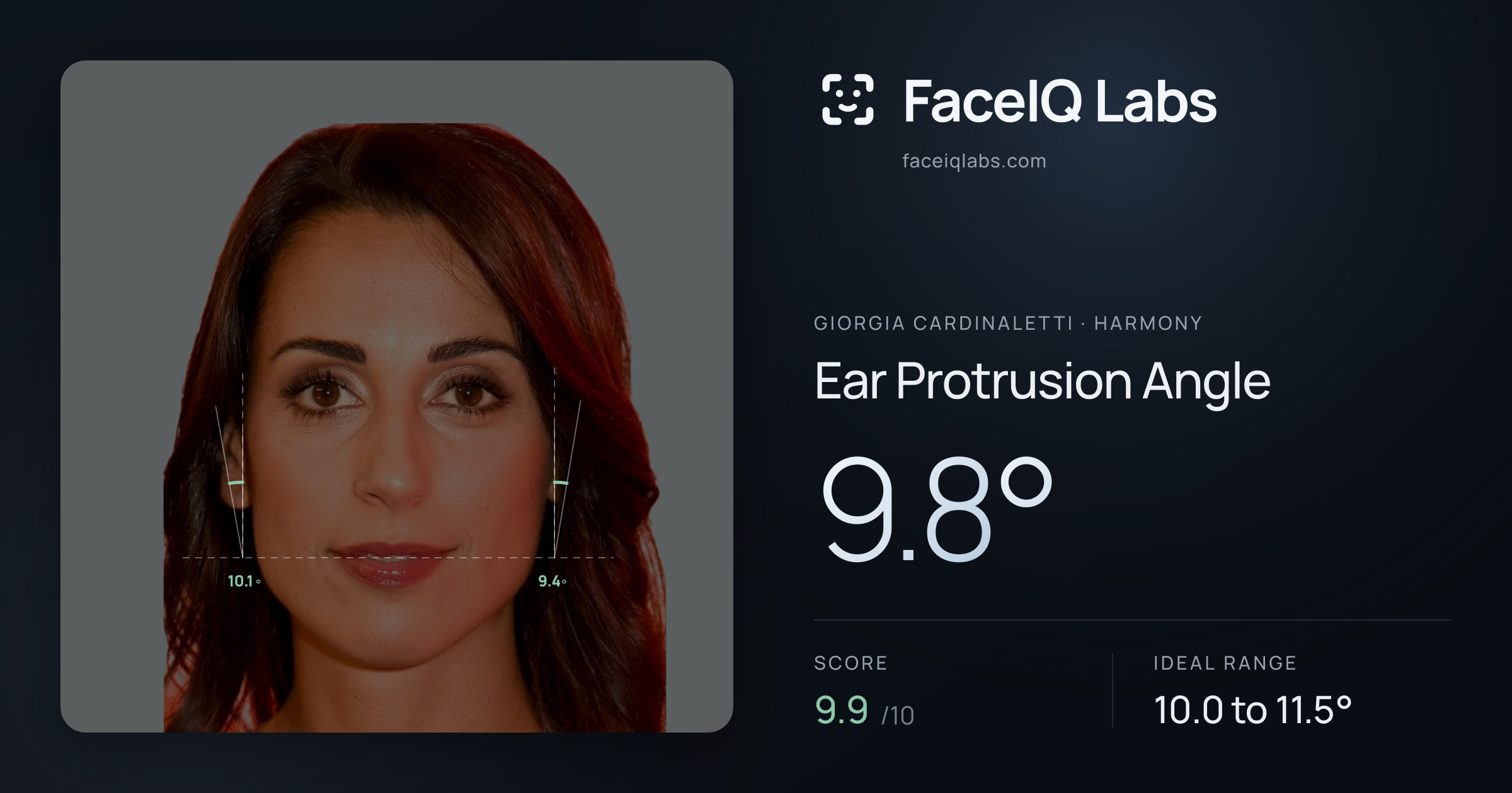 Giorgia Cardinaletti Ear Protrusion Angle: 9.8°, drawn on the photo