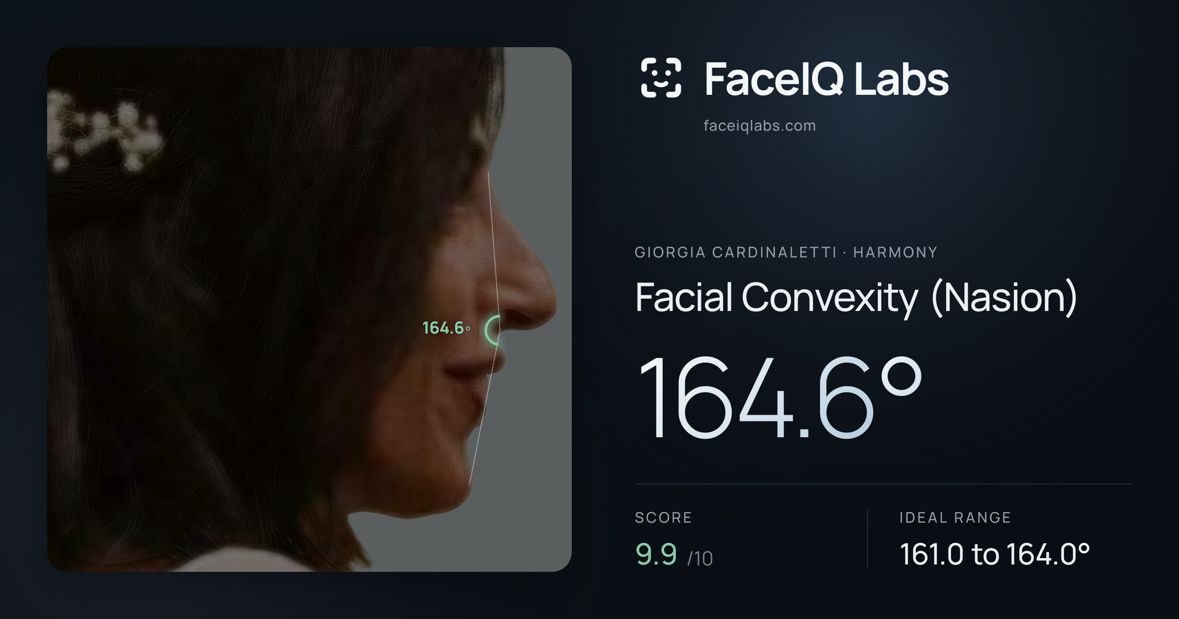 Giorgia Cardinaletti Facial Convexity (Nasion): 164.6°, drawn on the photo