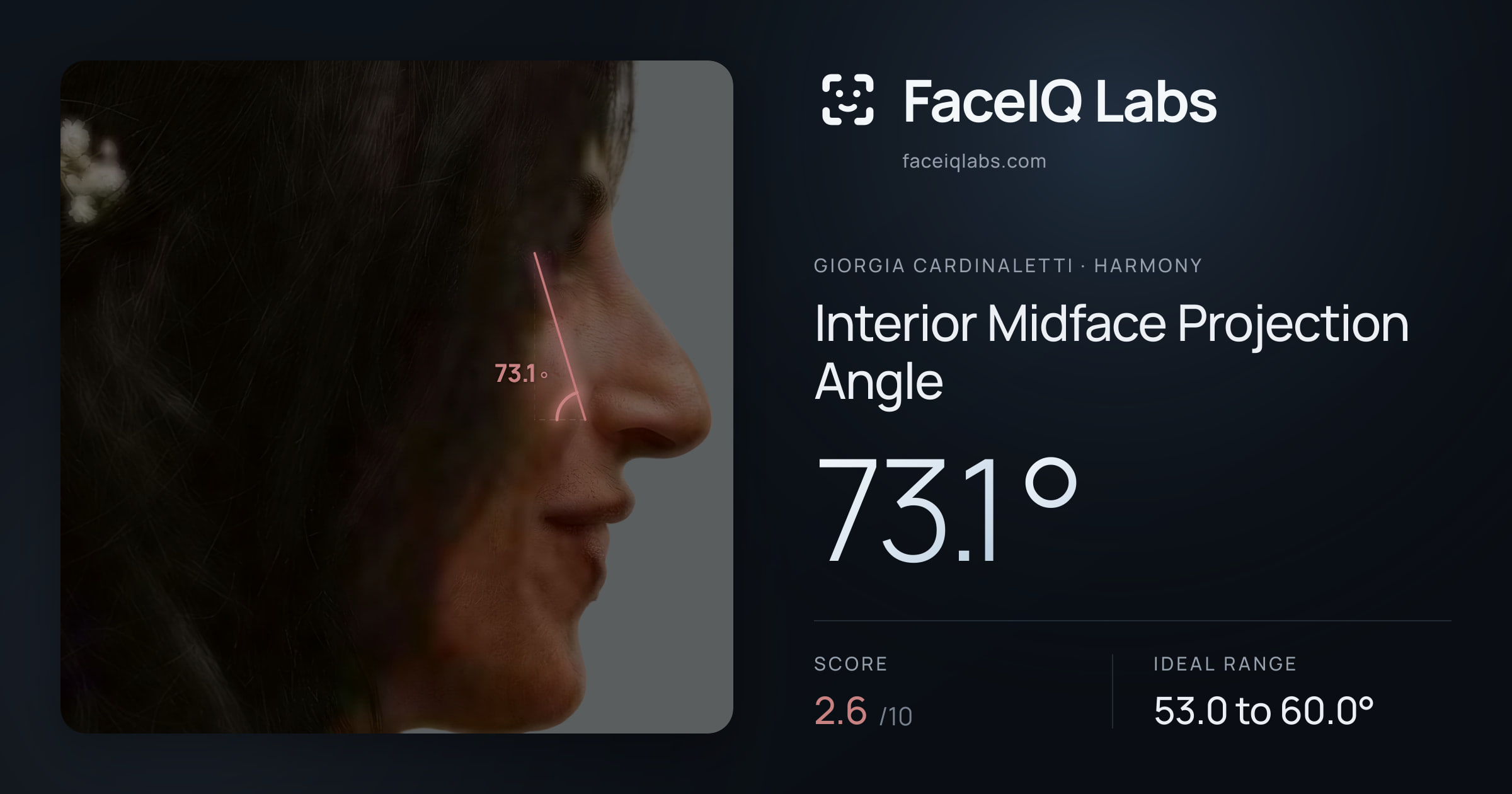 Giorgia Cardinaletti Interior Midface Projection Angle: 73.1°, drawn on the photo