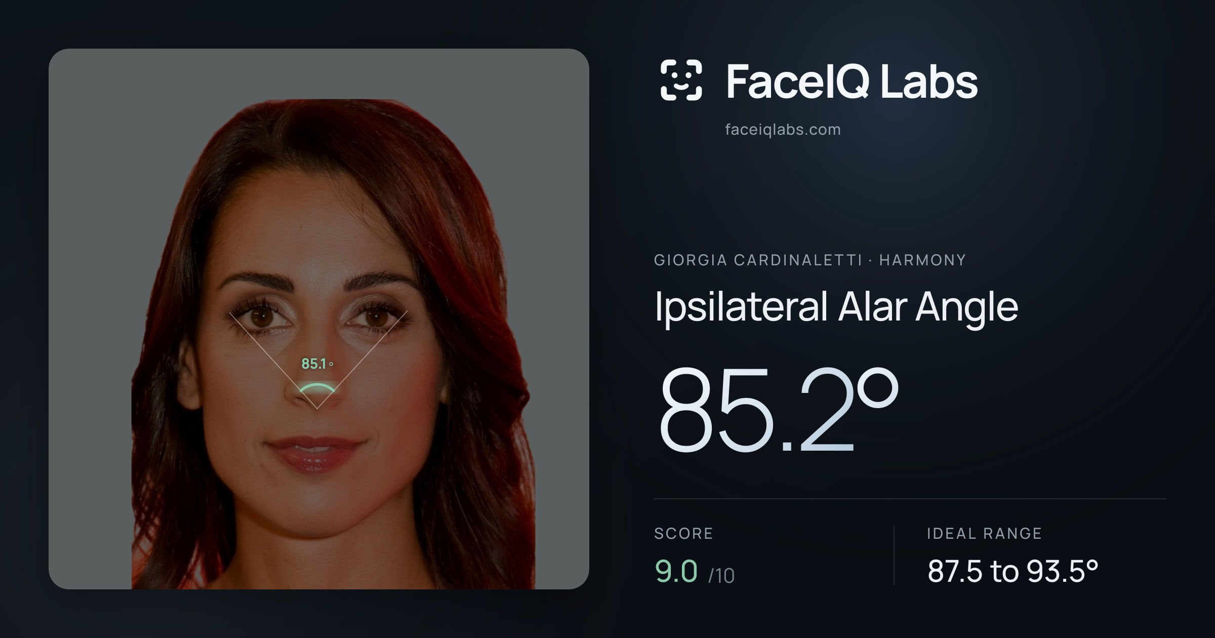 Giorgia Cardinaletti Ipsilateral Alar Angle: 85.2°, drawn on the photo