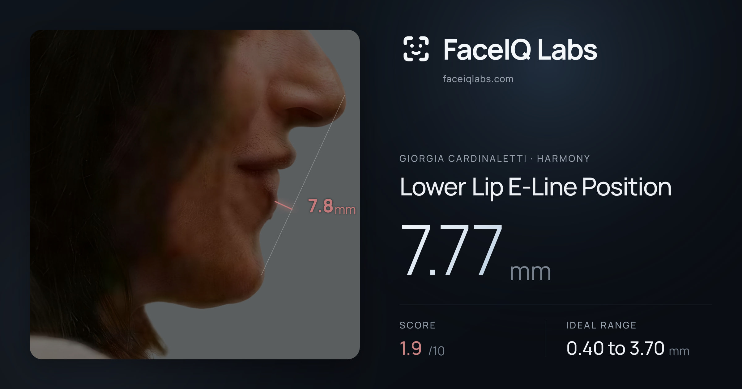 Giorgia Cardinaletti Lower Lip E-Line Position: 7.77mm, drawn on the photo