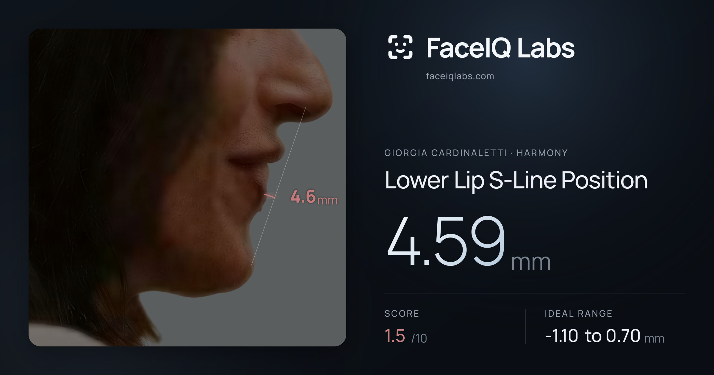 Giorgia Cardinaletti Lower Lip S-Line Position: 4.59mm, drawn on the photo