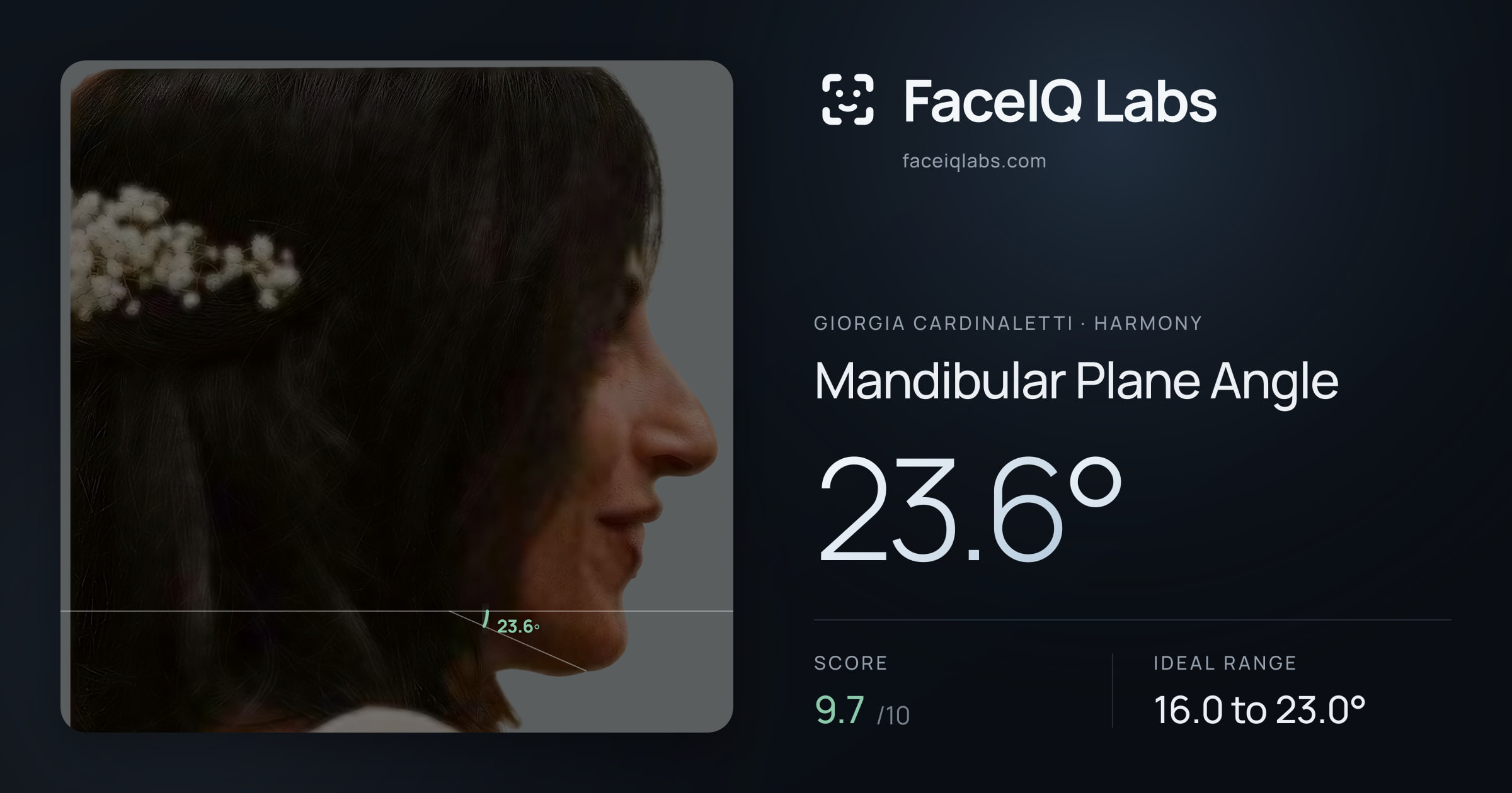 Giorgia Cardinaletti Mandibular Plane Angle: 23.6°, drawn on the photo