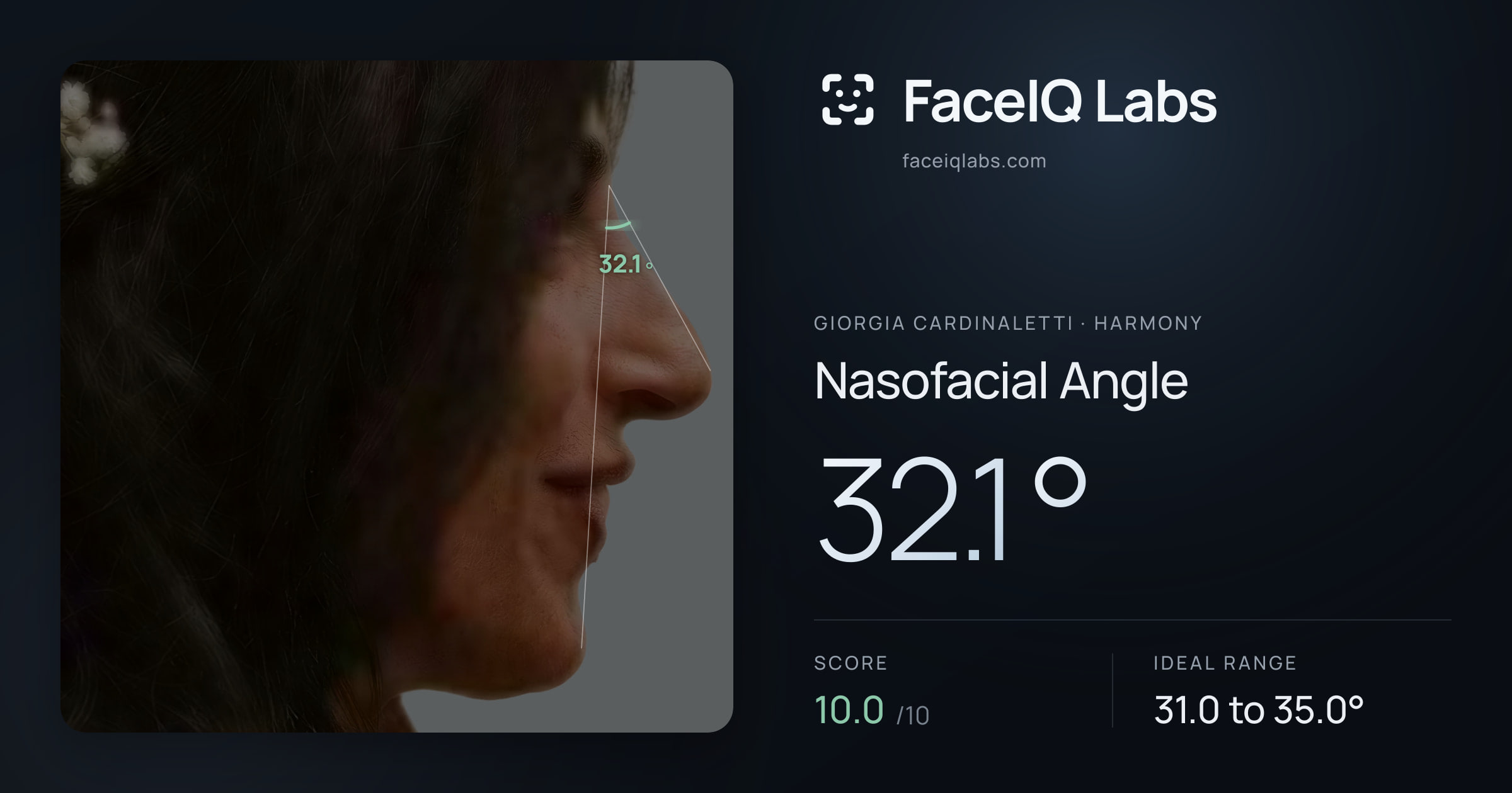 Giorgia Cardinaletti Nasofacial Angle: 32.1°, drawn on the photo