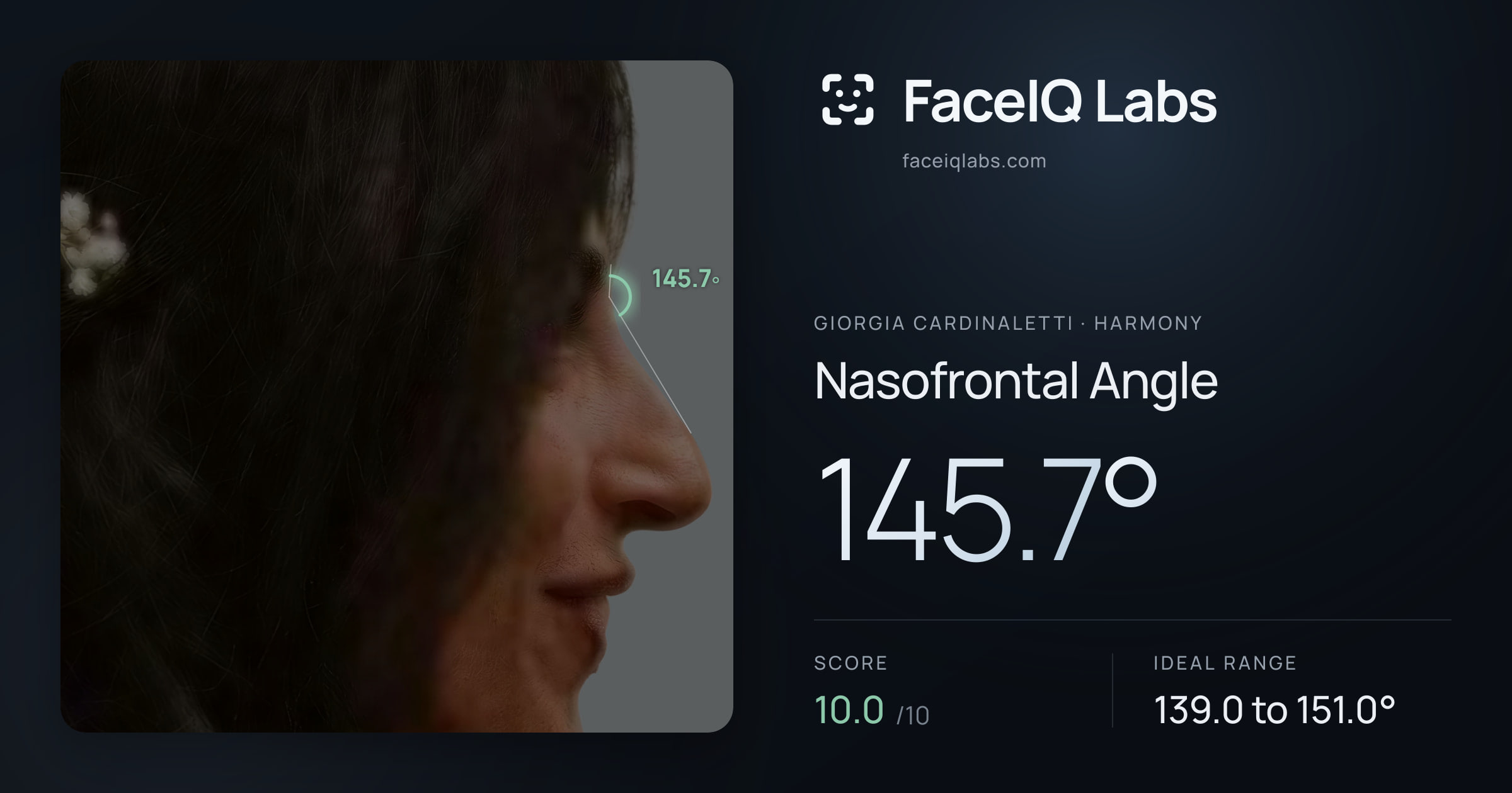 Giorgia Cardinaletti Nasofrontal Angle: 145.7°, drawn on the photo