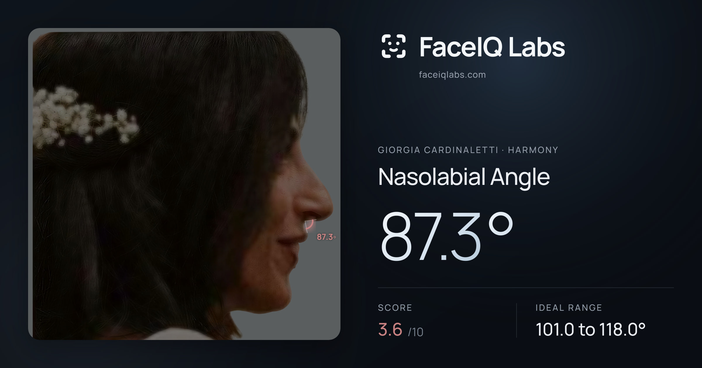 Giorgia Cardinaletti Nasolabial Angle: 87.3°, drawn on the photo