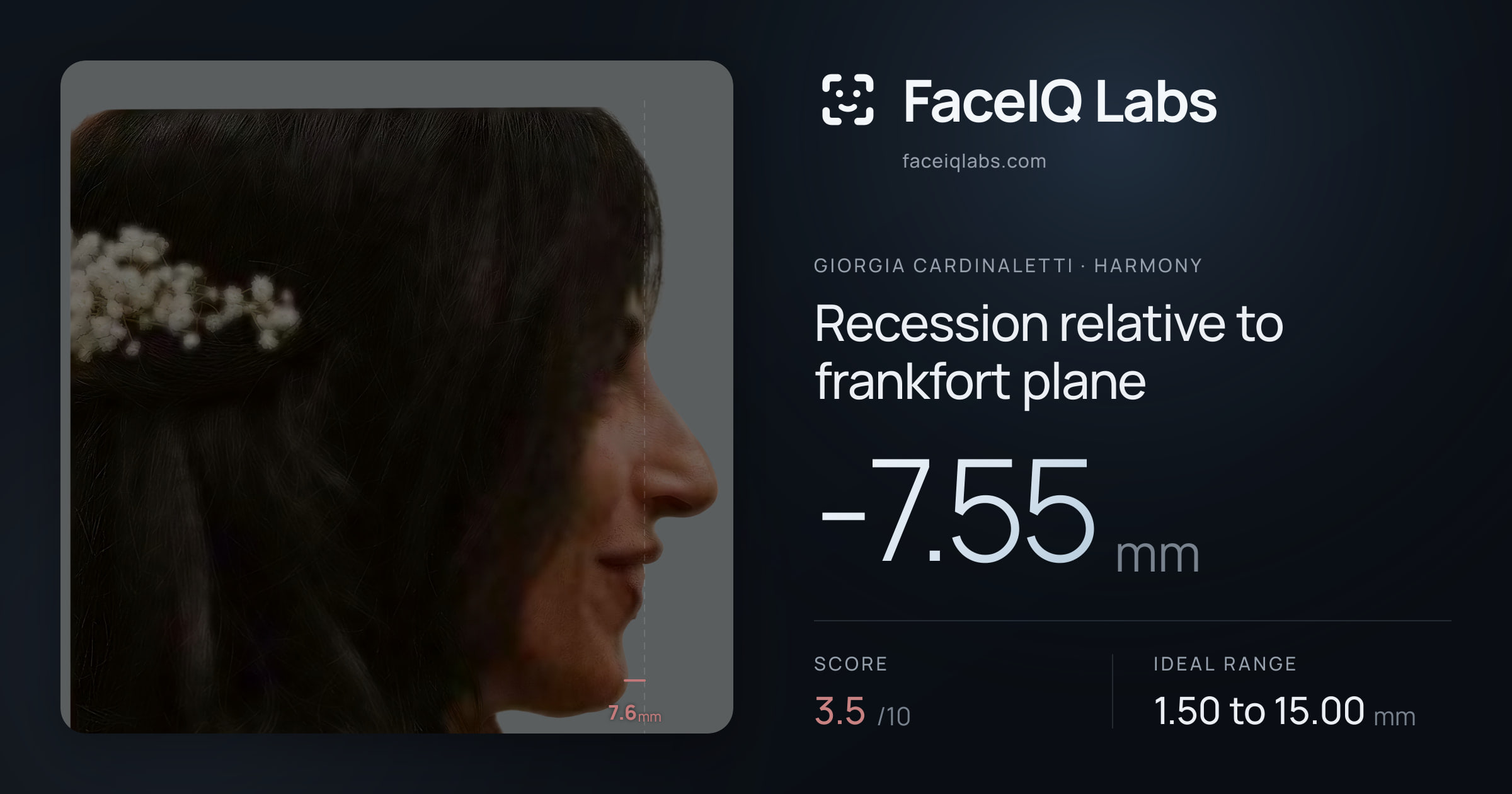Giorgia Cardinaletti Recession relative to frankfort plane: -7.55mm, drawn on the photo