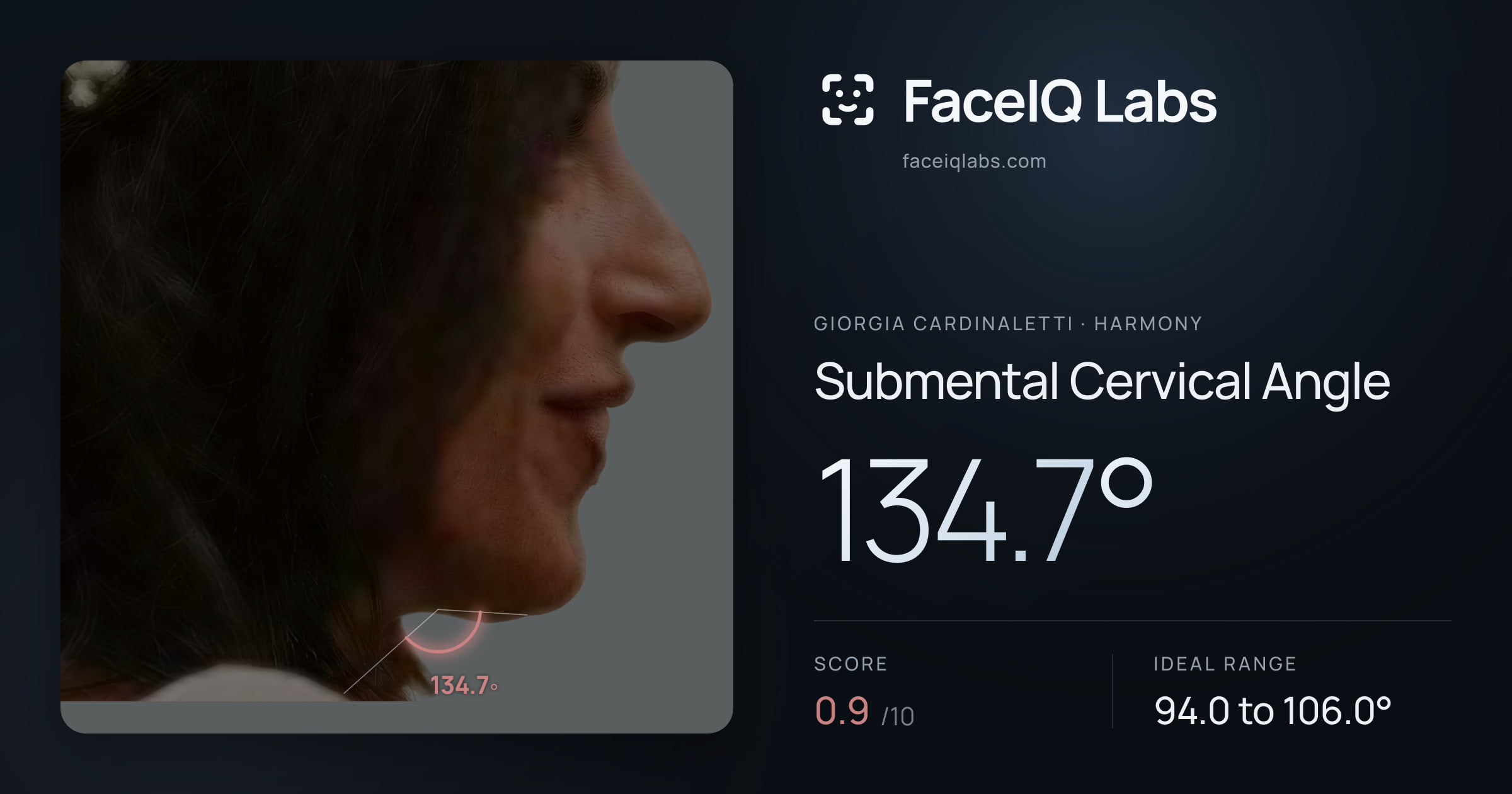 Giorgia Cardinaletti Submental Cervical Angle: 134.7°, drawn on the photo
