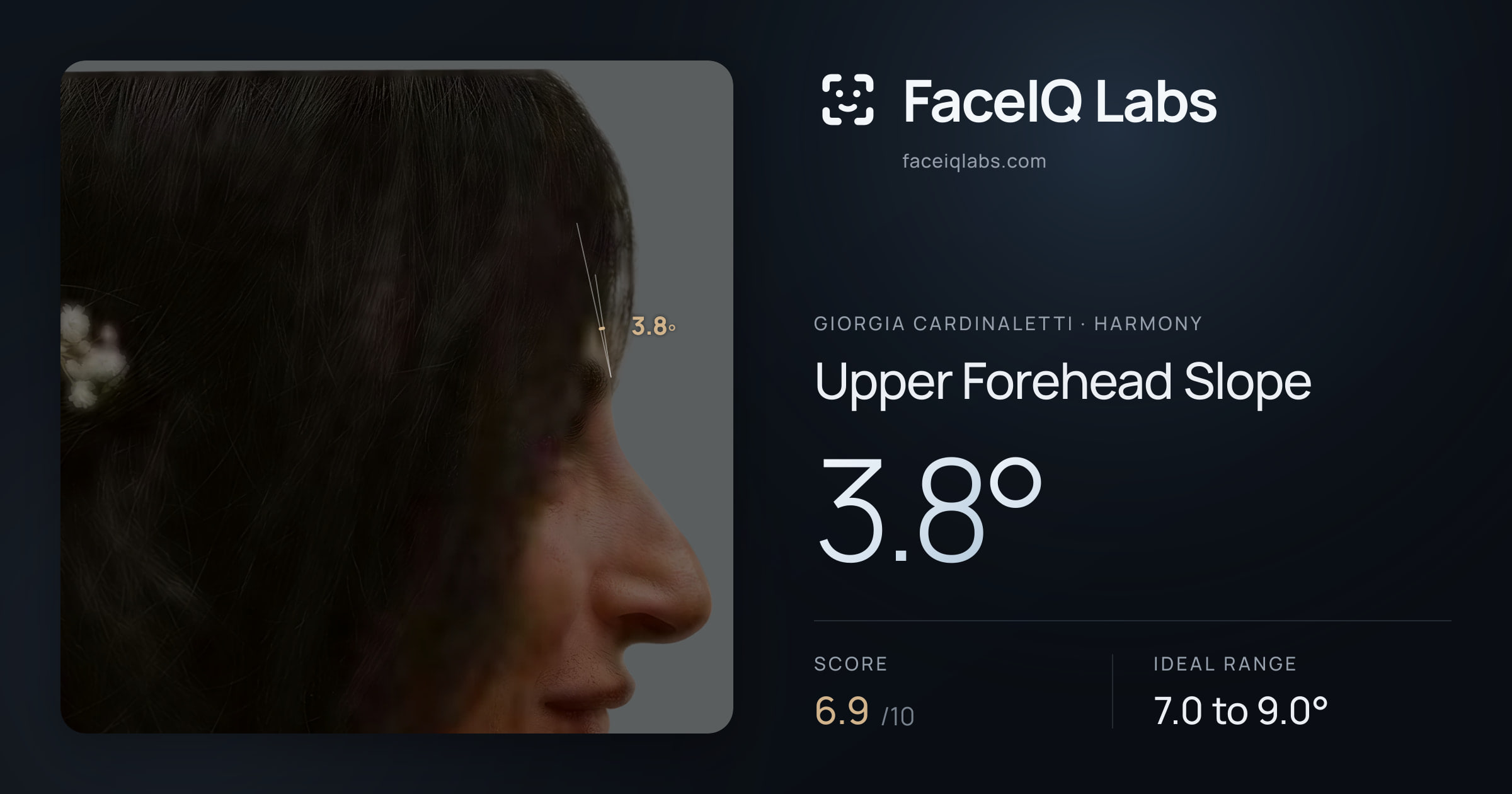 Giorgia Cardinaletti Upper Forehead Slope: 3.8°, drawn on the photo