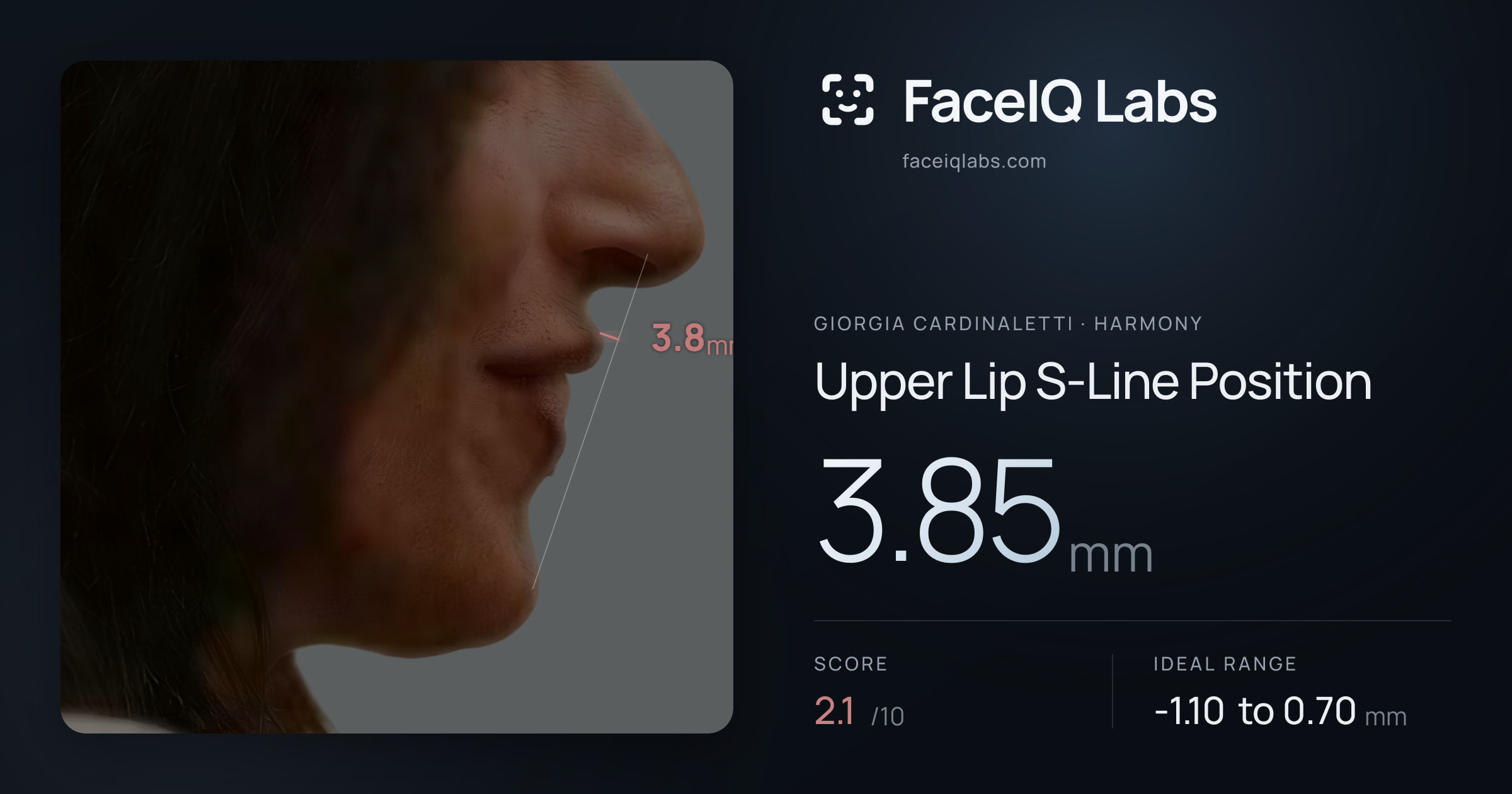 Giorgia Cardinaletti Upper Lip S-Line Position: 3.85mm, drawn on the photo