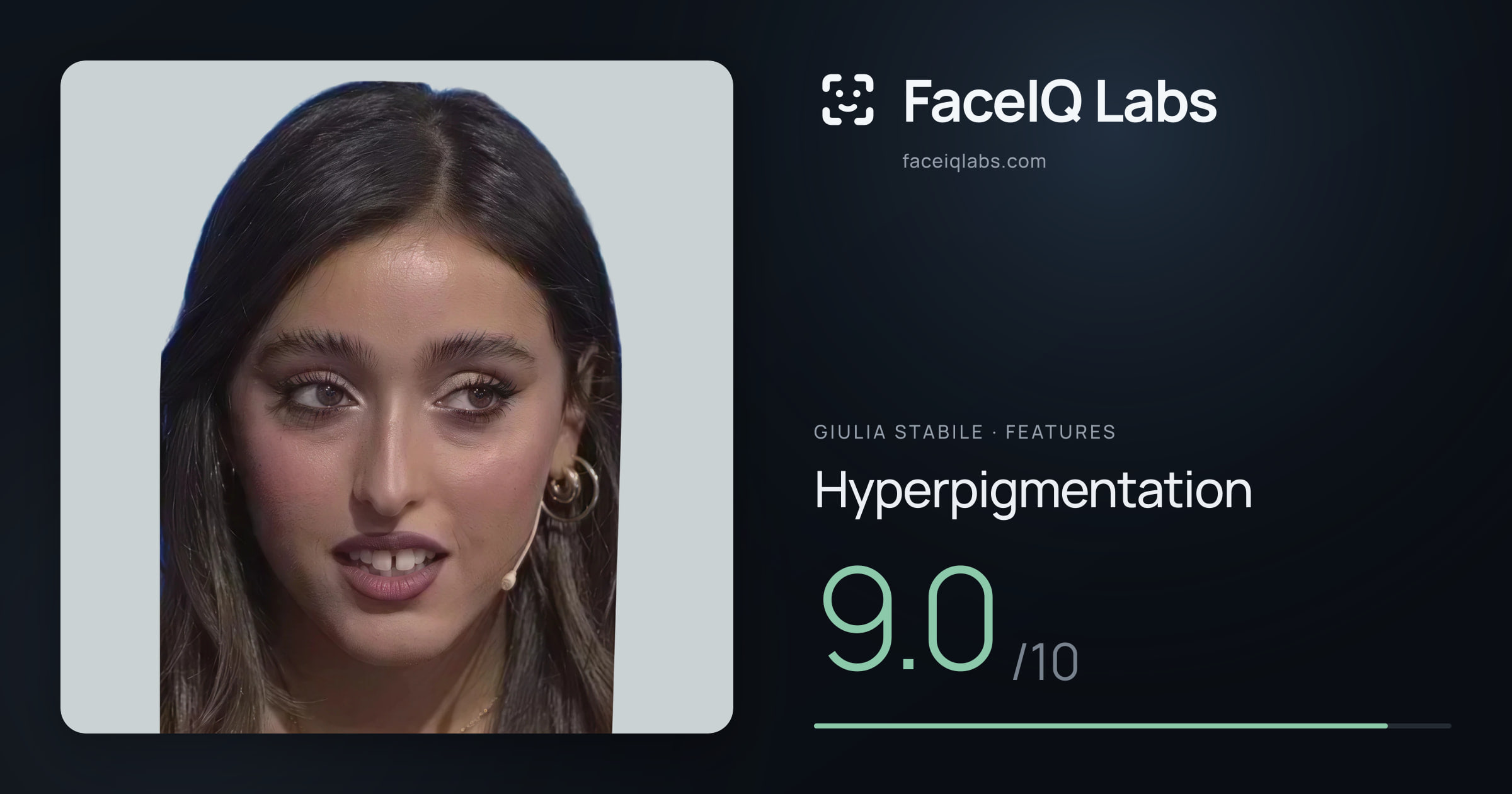 Giulia Stabile Hyperpigmentation: 9.0/10, drawn on the photo