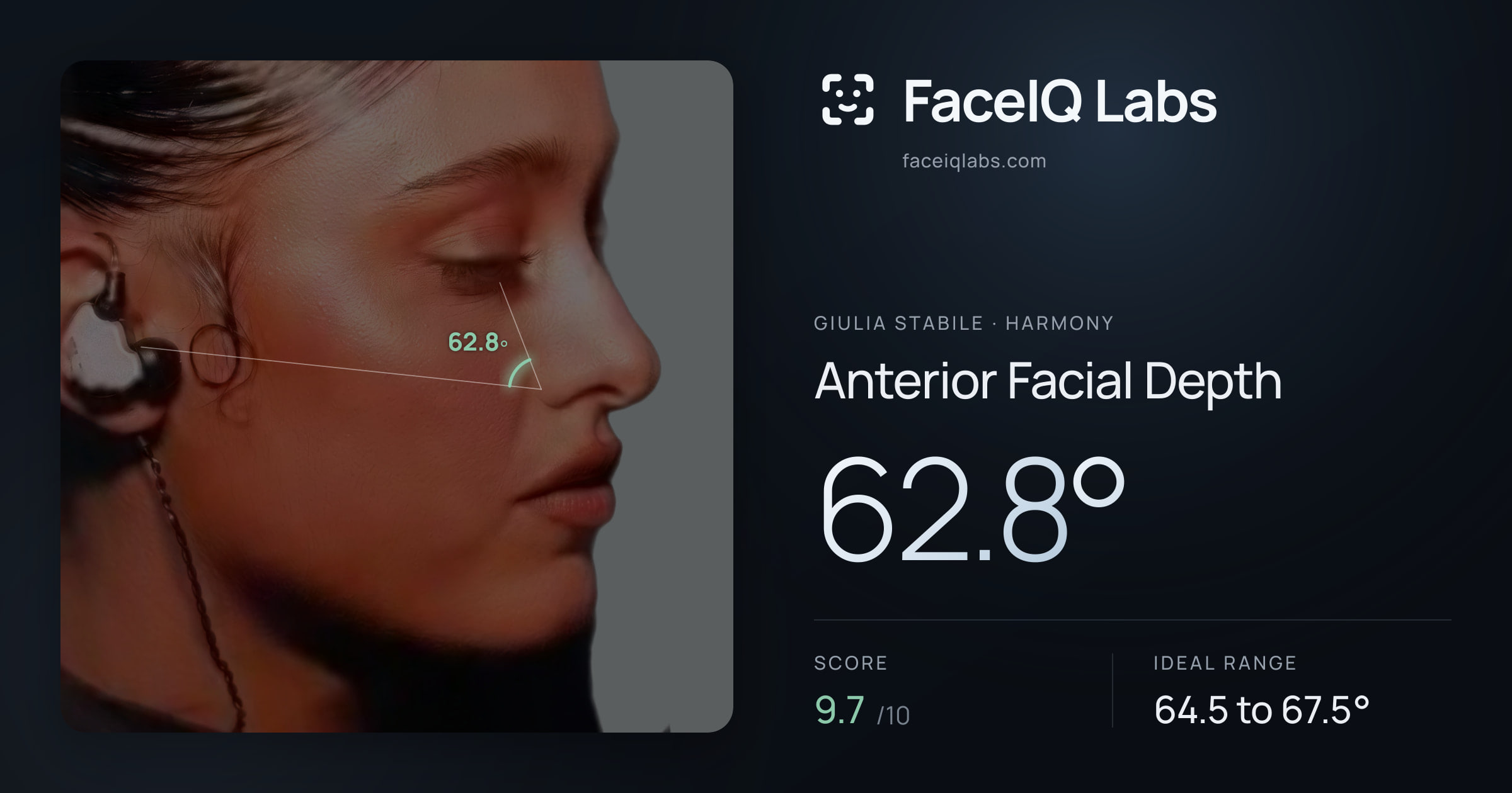 Giulia Stabile Anterior Facial Depth: 62.8°, drawn on the photo