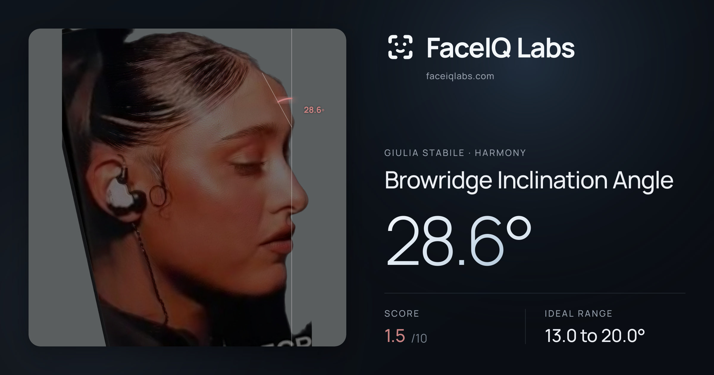 Giulia Stabile Browridge Inclination Angle: 28.6°, drawn on the photo