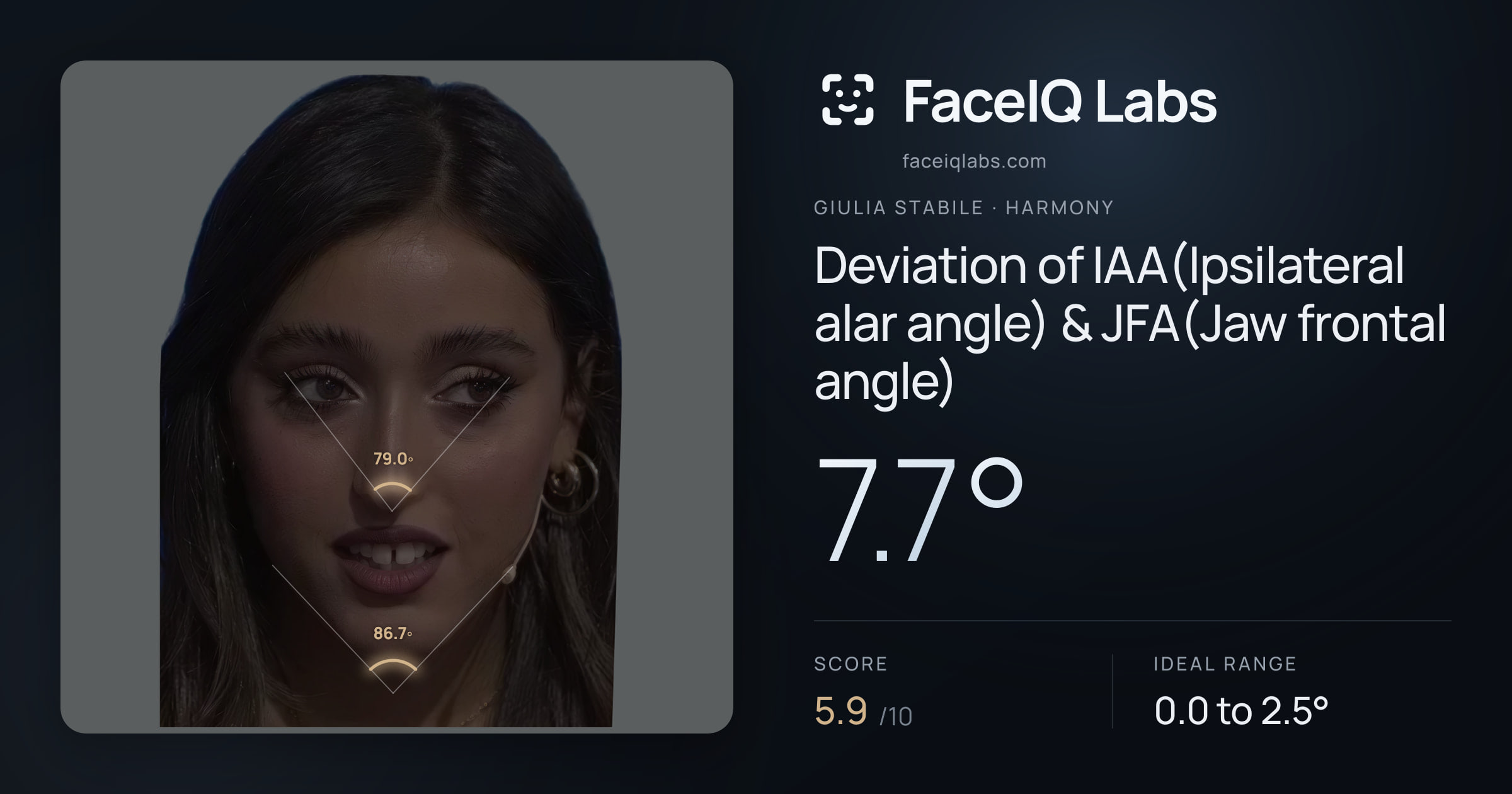 Giulia Stabile Deviation of IAA(Ipsilateral alar angle) & JFA(Jaw frontal angle): 7.7°, drawn on the photo