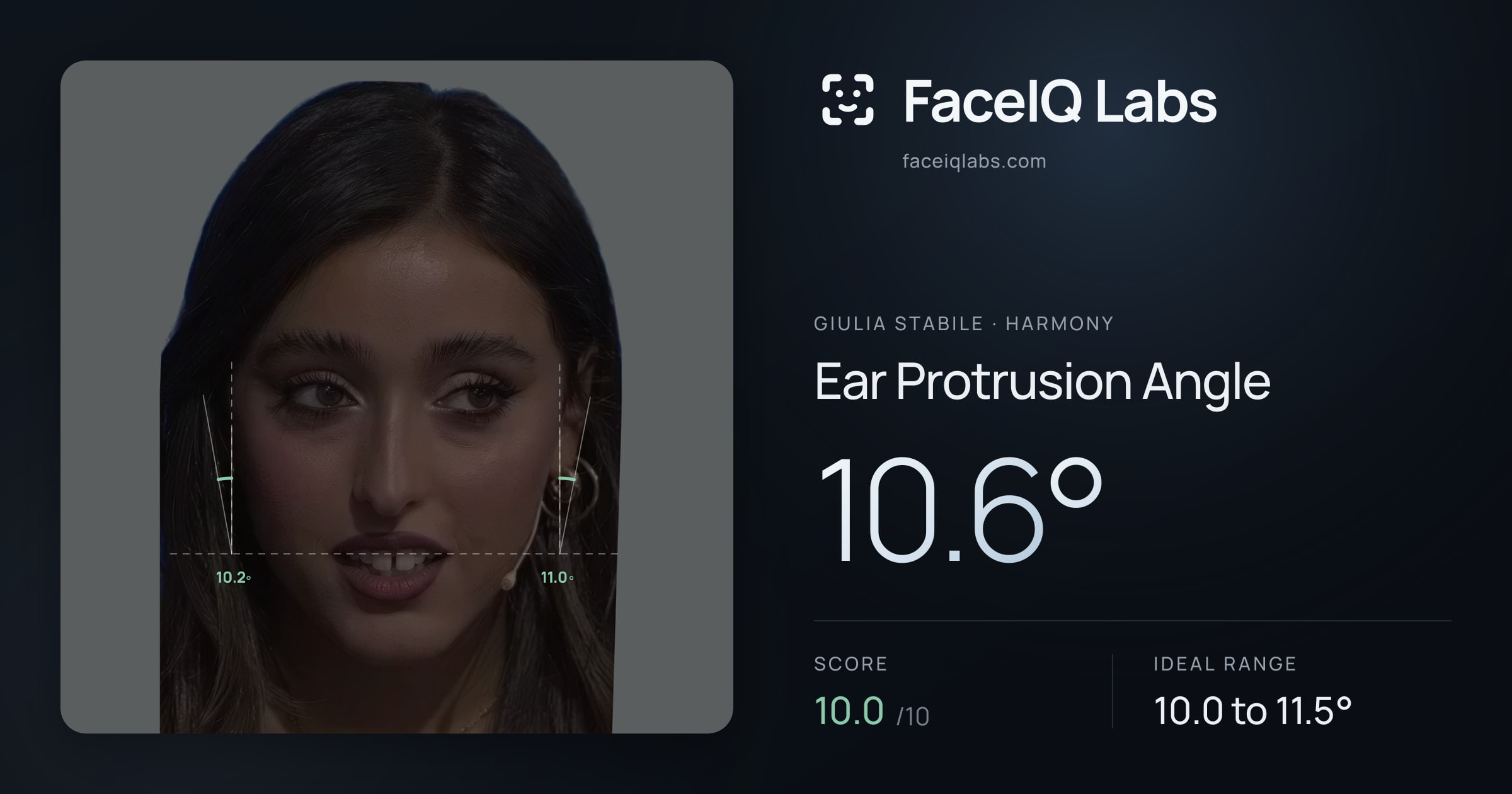 Giulia Stabile Ear Protrusion Angle: 10.6°, drawn on the photo