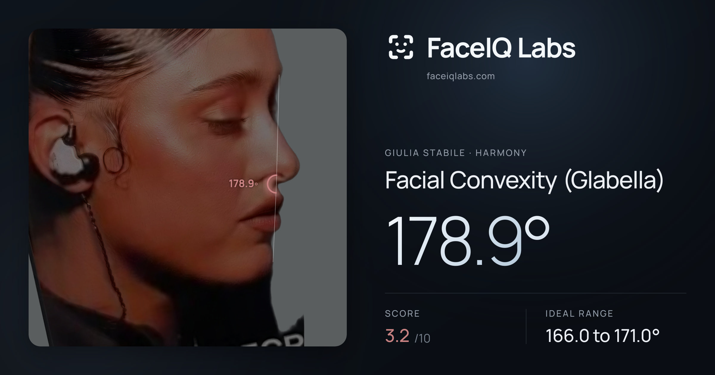 Giulia Stabile Facial Convexity (Glabella): 178.9°, drawn on the photo