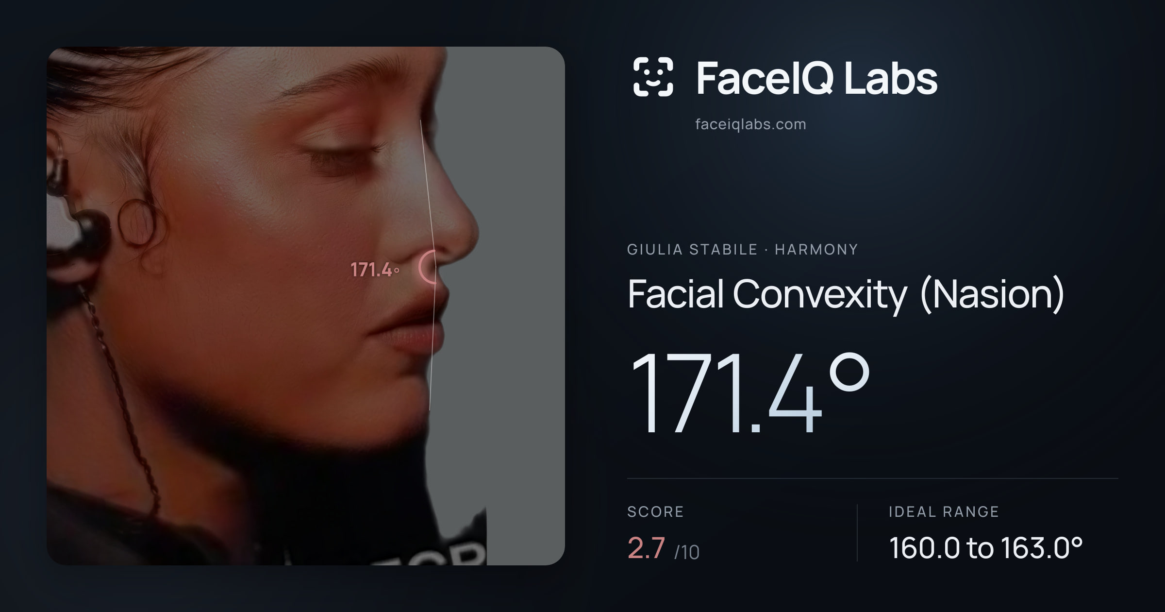 Giulia Stabile Facial Convexity (Nasion): 171.4°, drawn on the photo