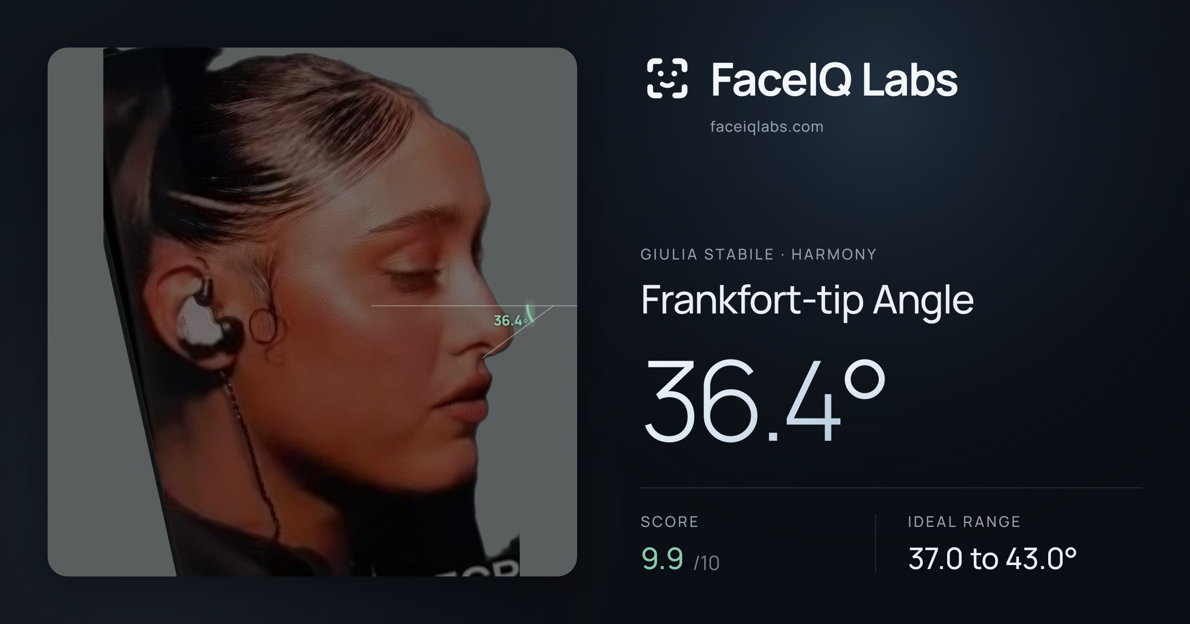 Giulia Stabile Frankfort-tip Angle: 36.4°, drawn on the photo