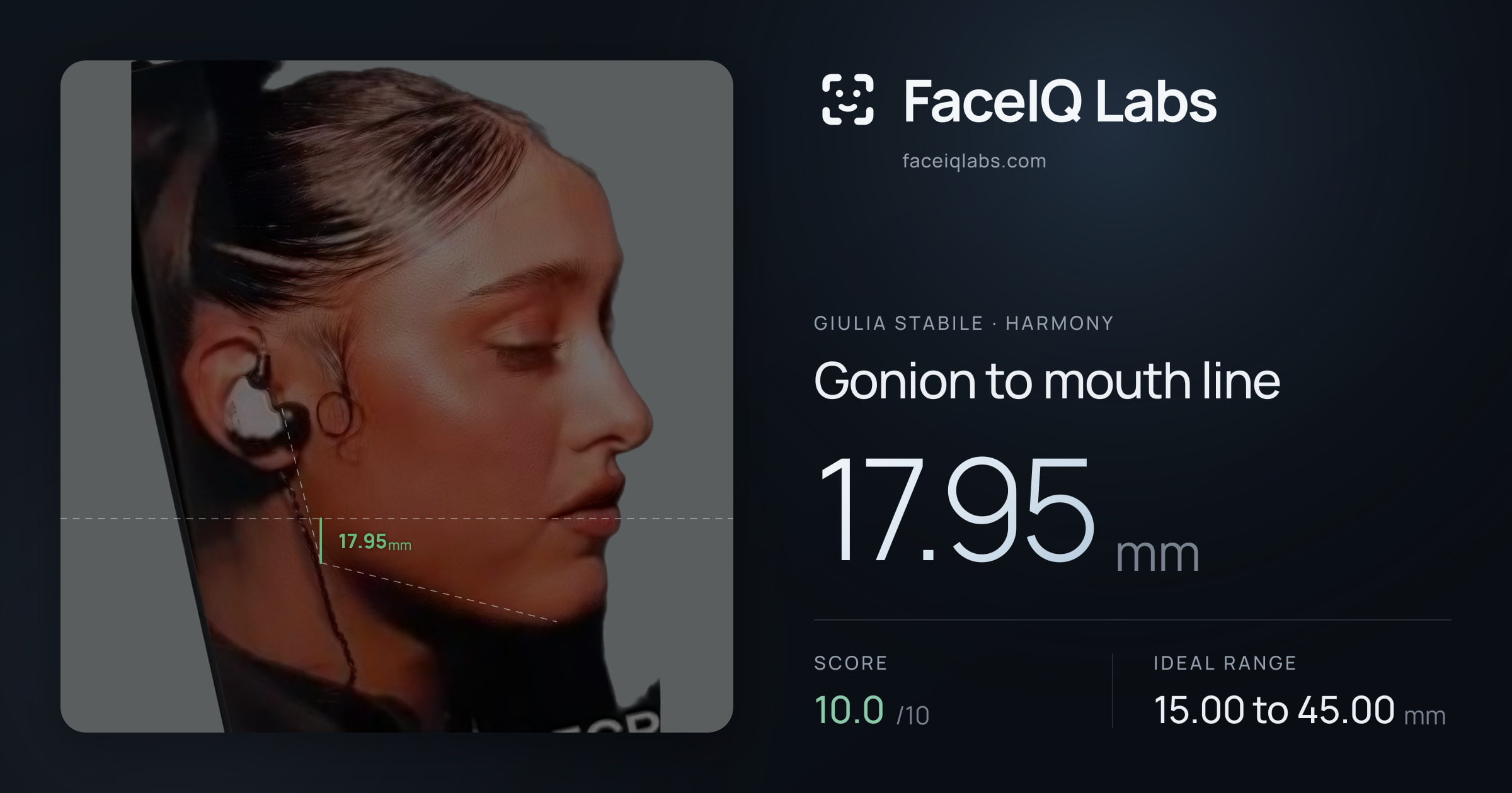 Giulia Stabile Gonion to mouth line: 17.95mm, drawn on the photo