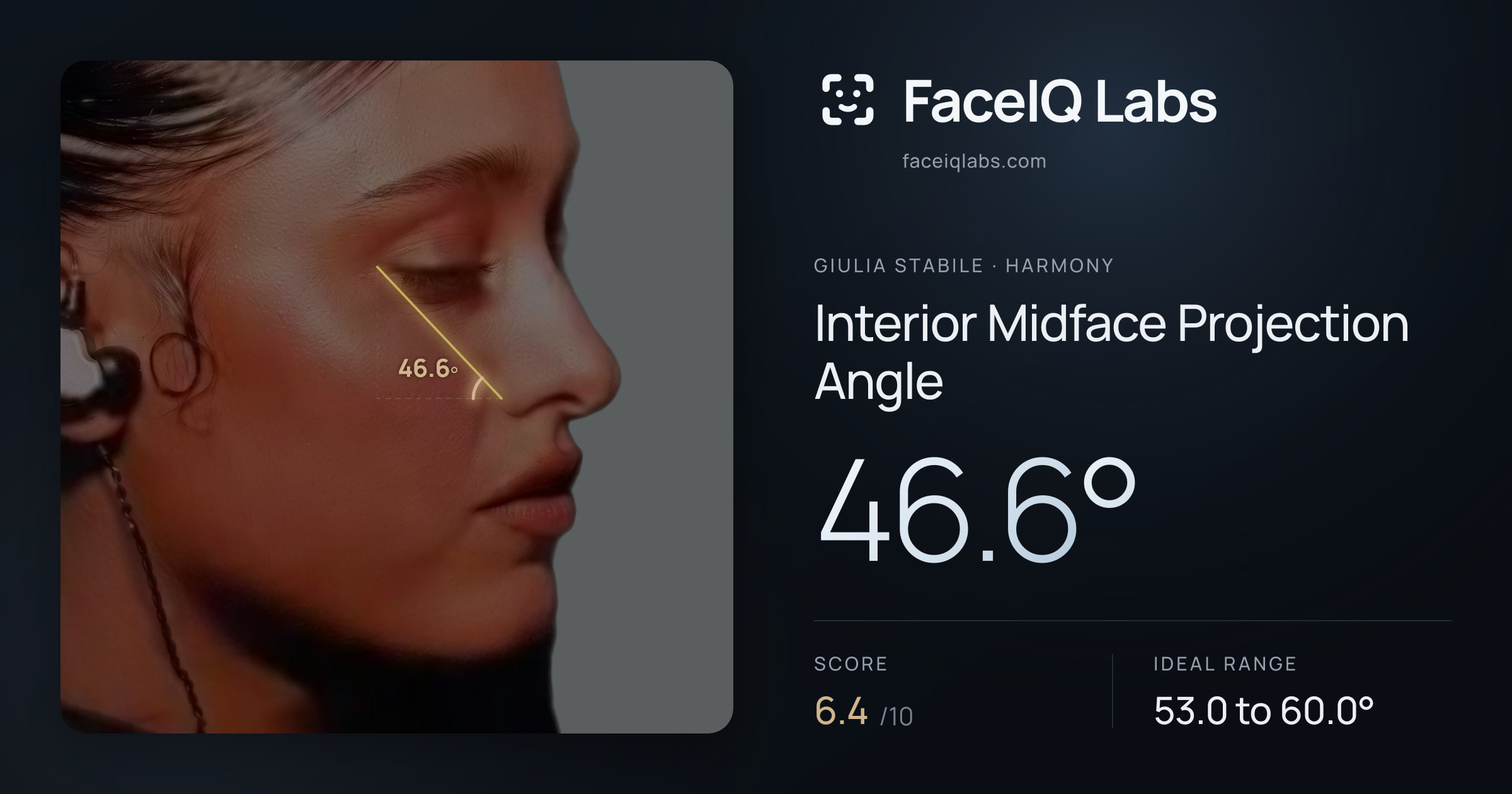 Giulia Stabile Interior Midface Projection Angle: 46.6°, drawn on the photo