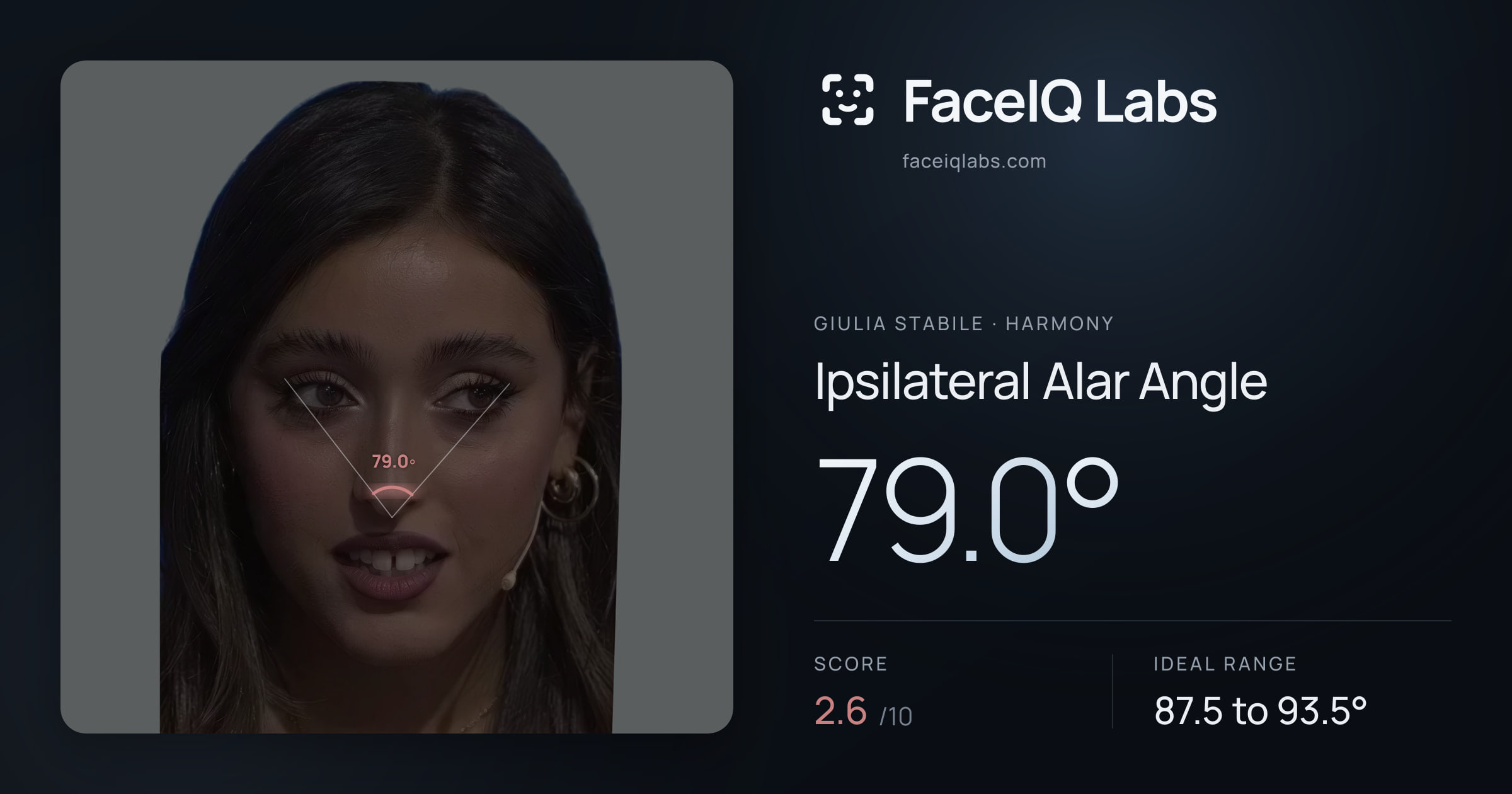 Giulia Stabile Ipsilateral Alar Angle: 79.0°, drawn on the photo