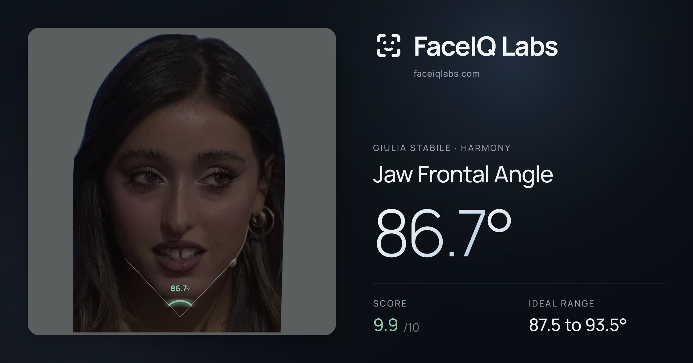 Giulia Stabile Jaw Frontal Angle: 86.7°, drawn on the photo