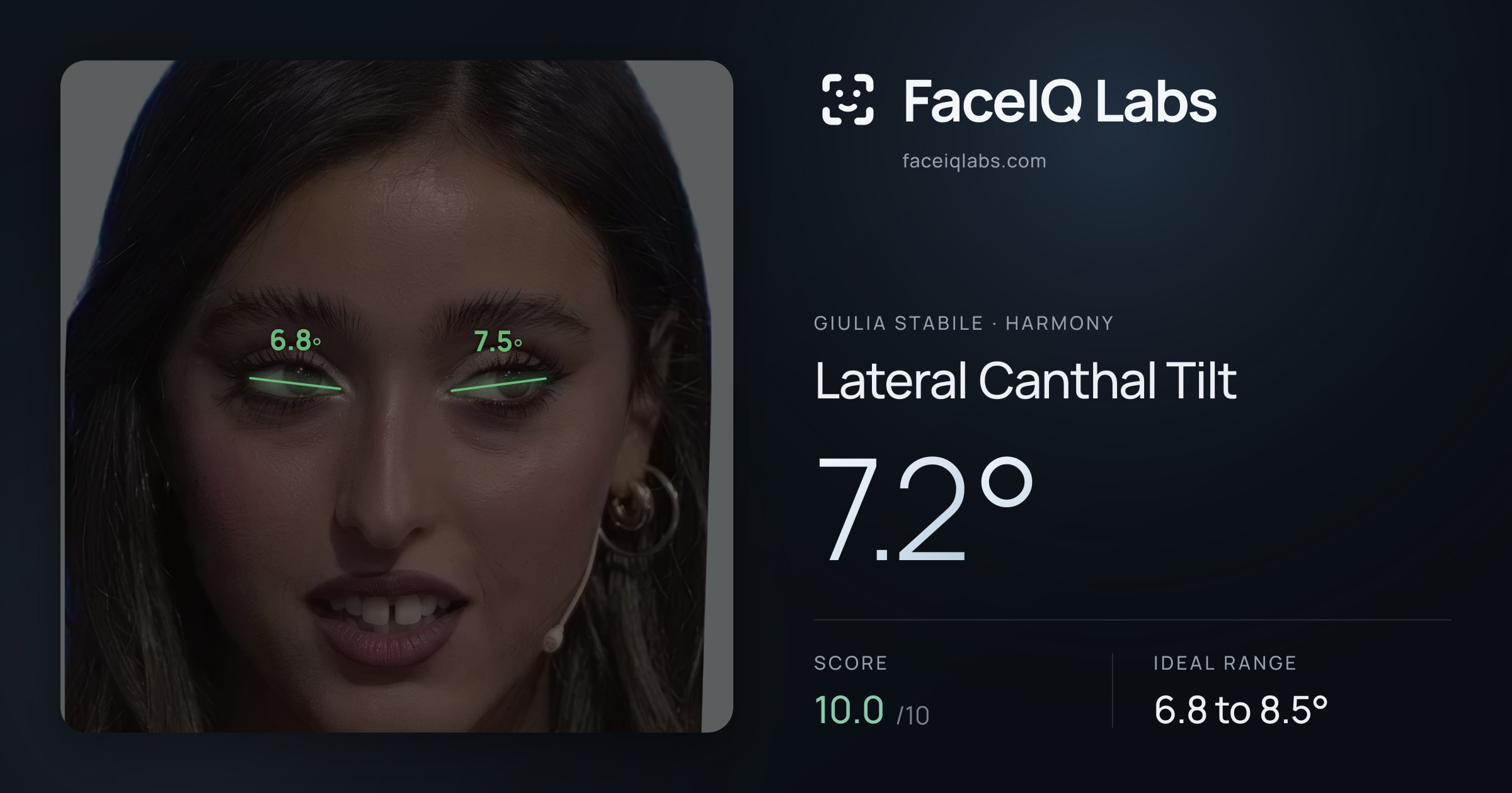 Giulia Stabile Lateral Canthal Tilt: 7.2°, drawn on the photo