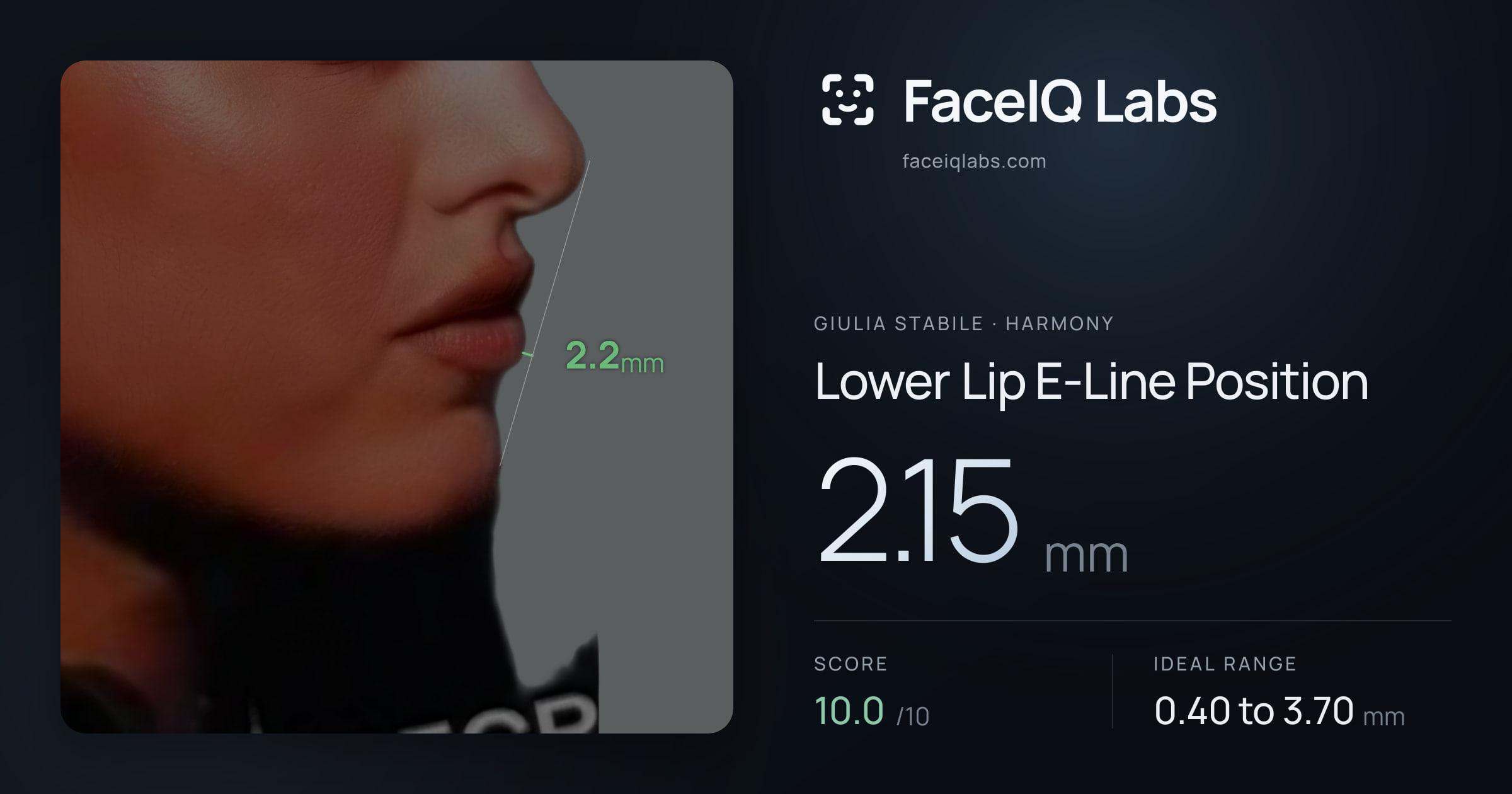 Giulia Stabile Lower Lip E-Line Position: 2.15mm, drawn on the photo